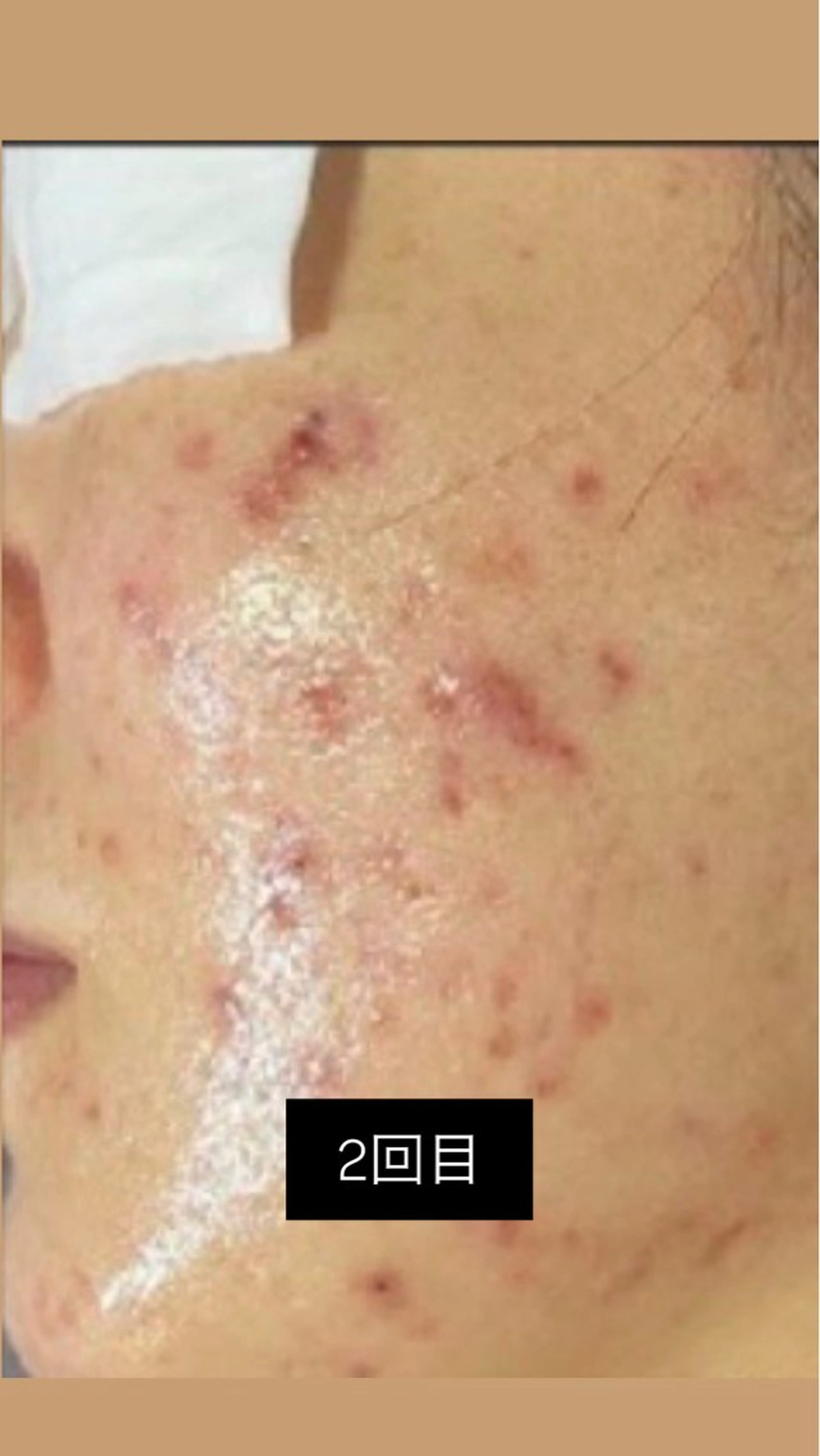 エステ 韓国🇰🇷価格 サロン_Nbibiのエステ・リラクイメージ