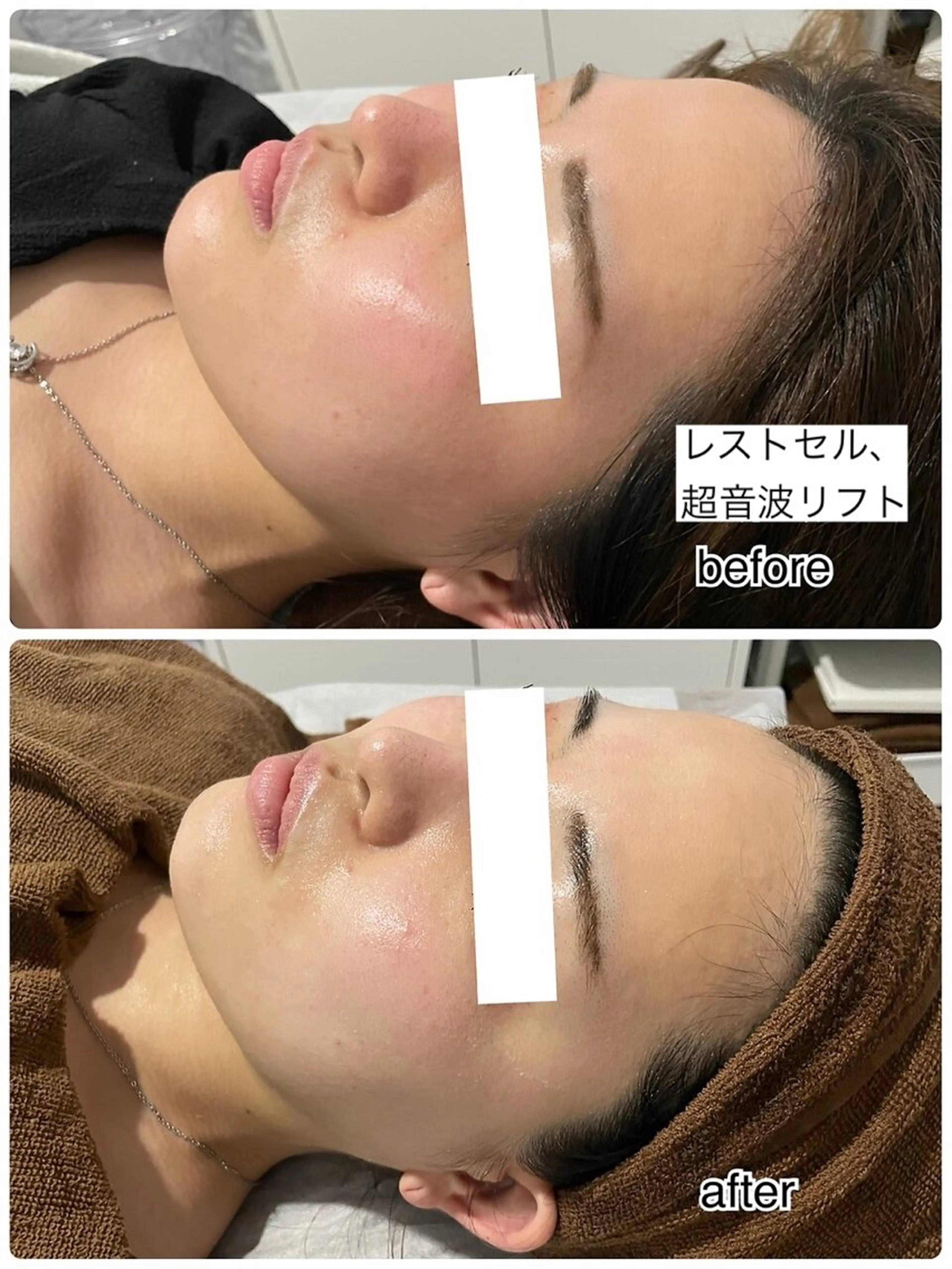 エステ ENCHANT 脱毛.小顔.毛穴のエステ・リラクイメージ