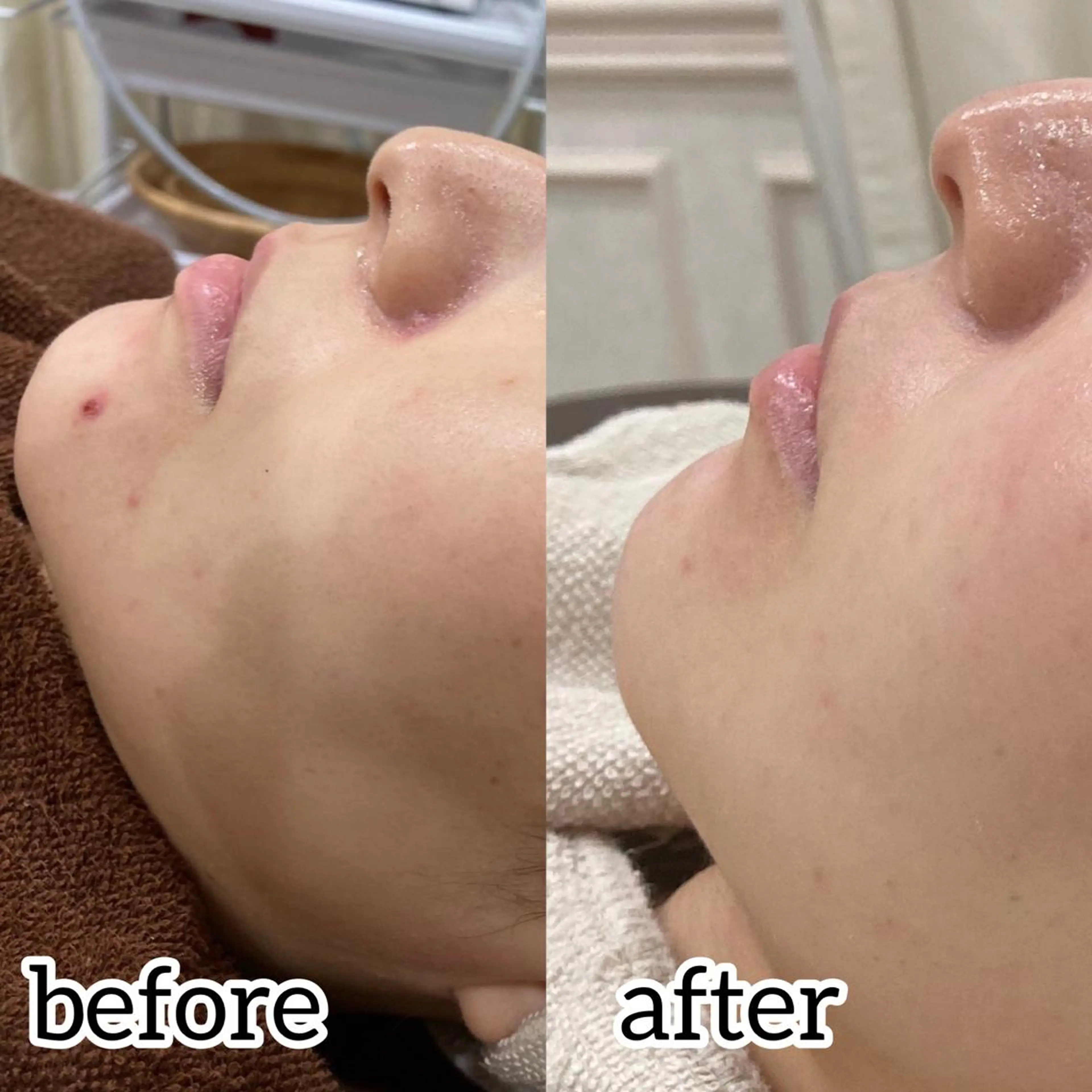 laluna saki...のその他イメージ