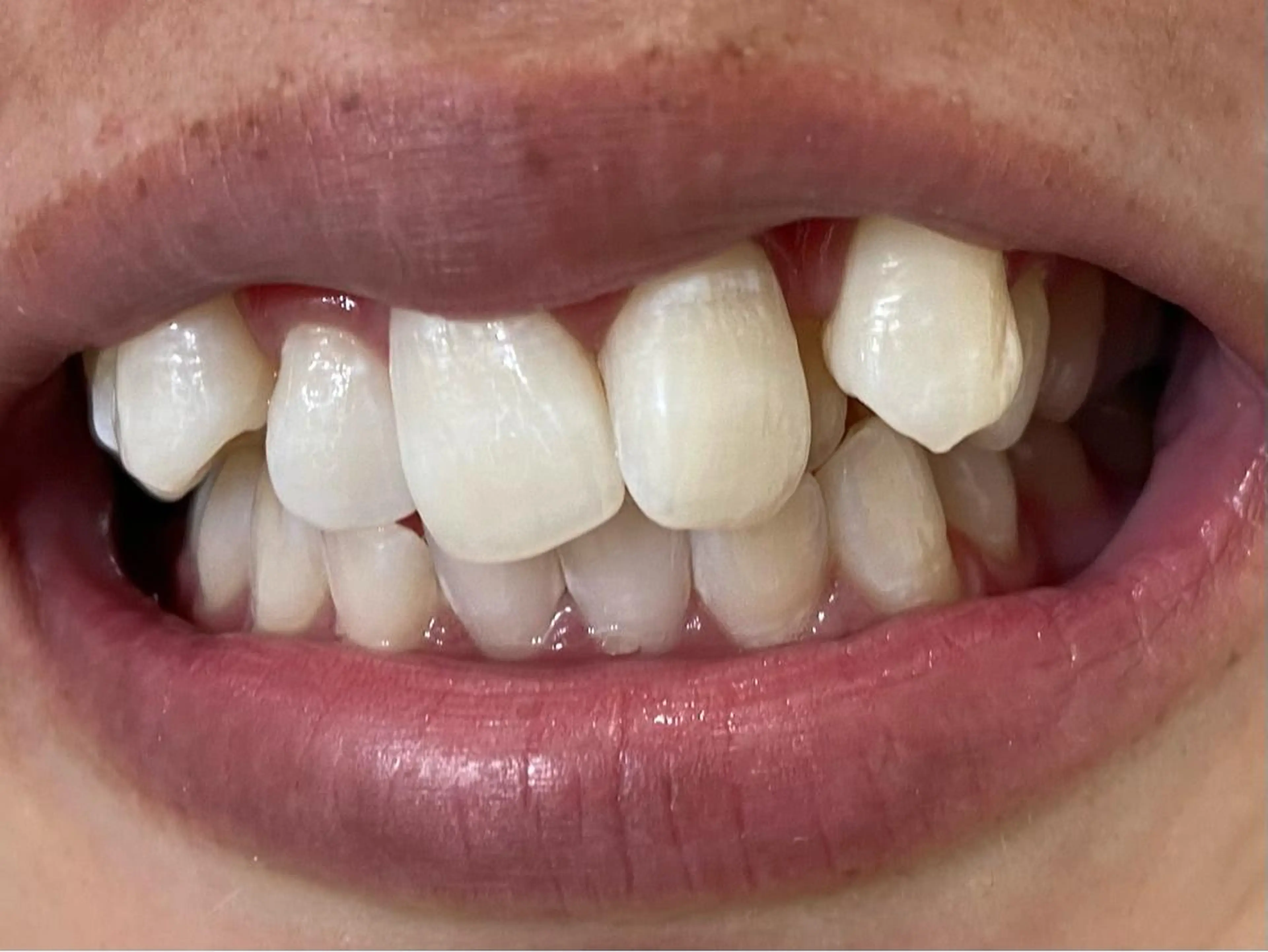 セルフホワイトニングサロン　ラヴィアン所属・ホワイトニングサロン La vie enのその他イメージ