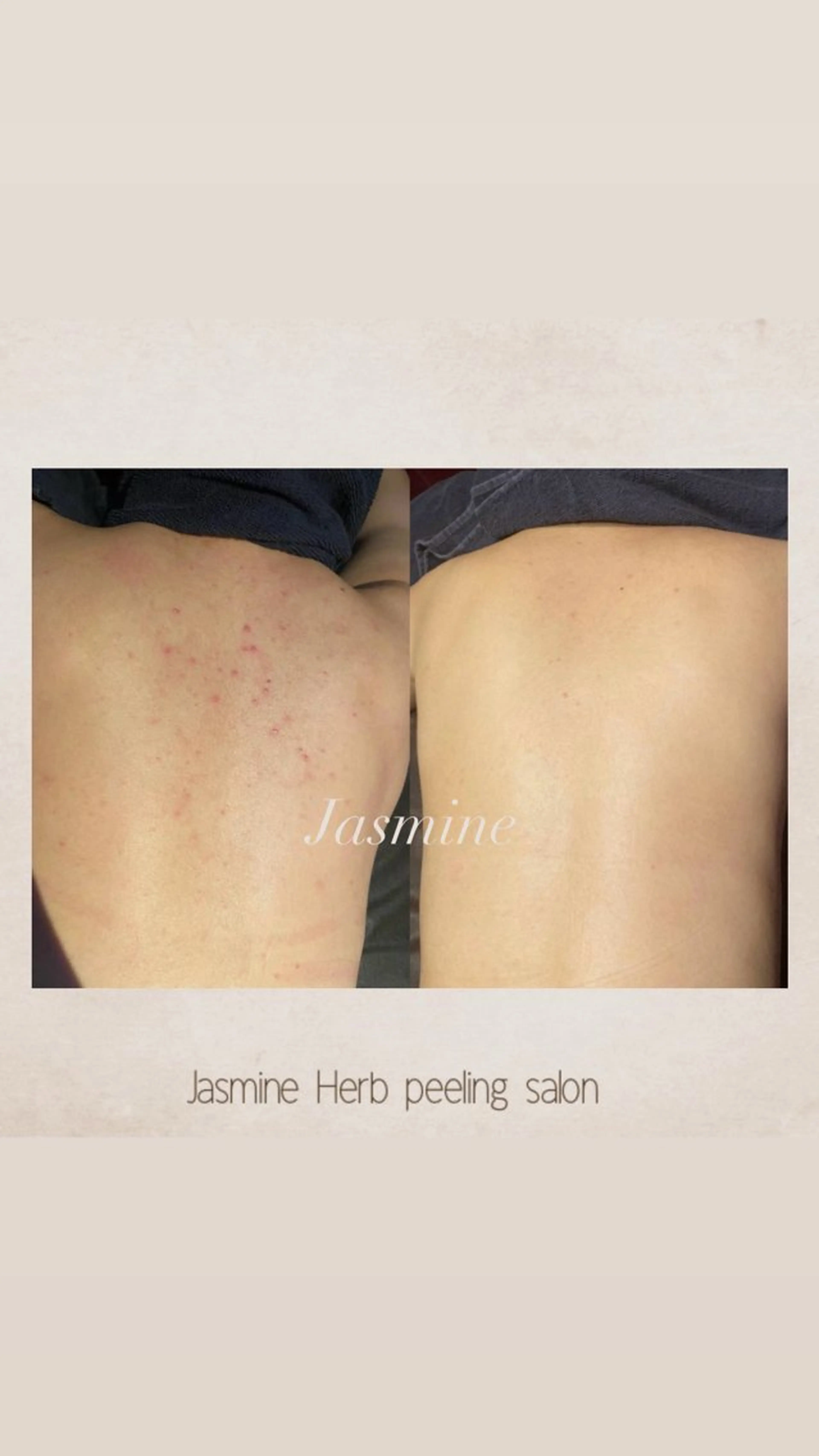 Jasmine所属・Jasmine herbのエステ・リラクイメージ