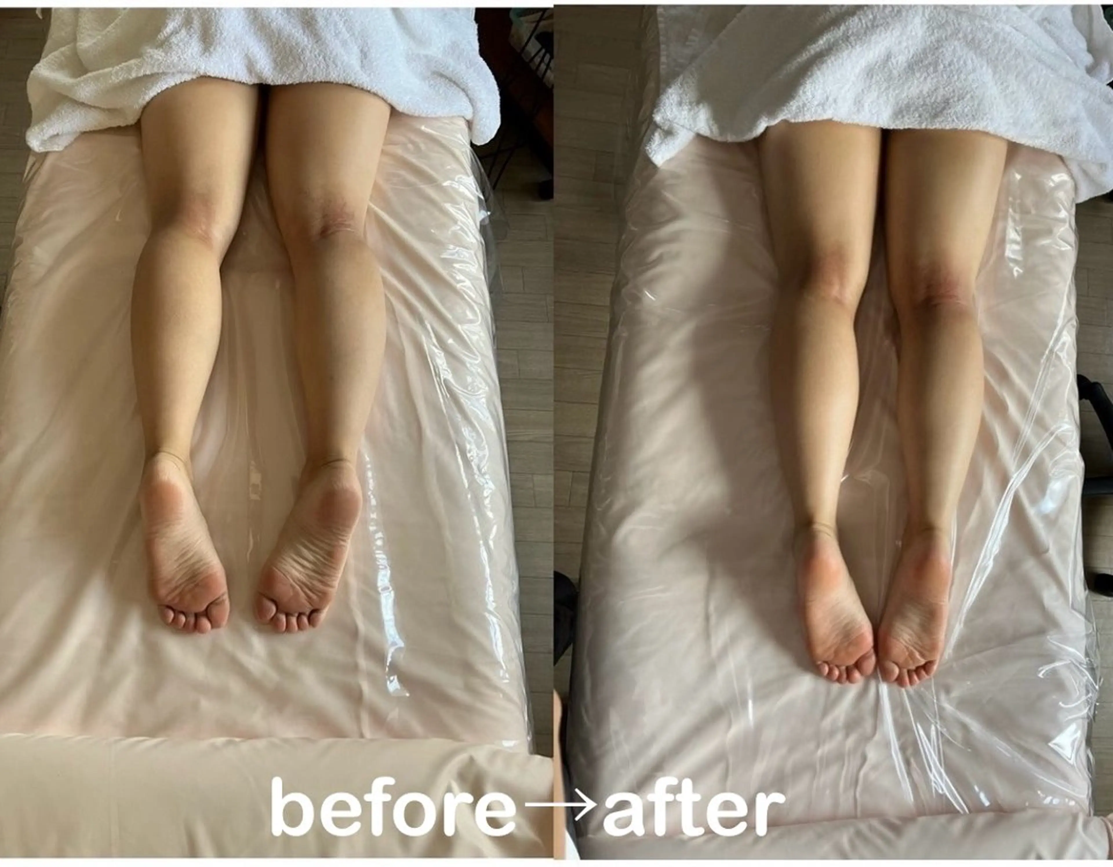 脚のだるさ慢性的な浮腫を撃退☆INDIBA BODY(インディバ　ボディ)150分☆何度でもご利用可能♪の写真