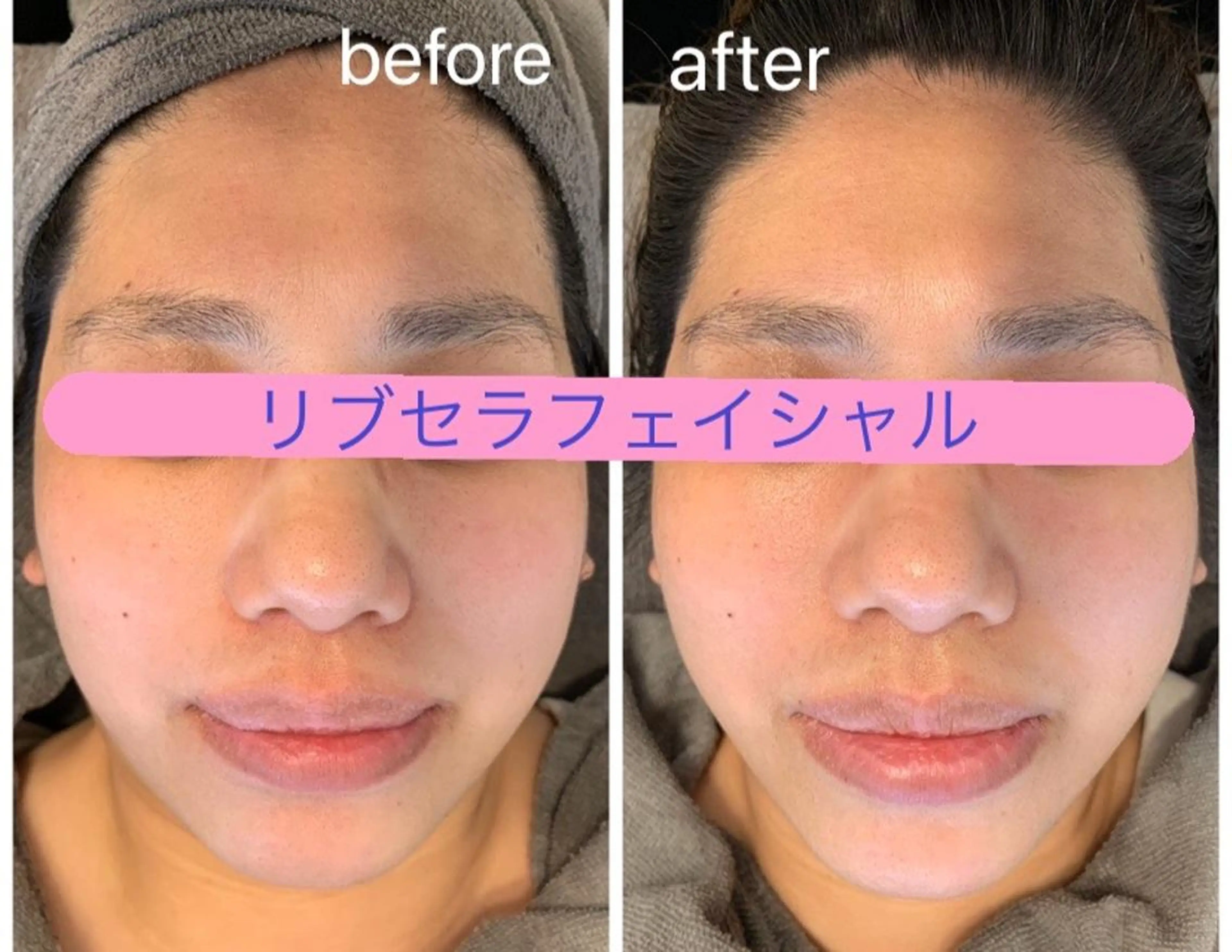 エステ Private Salon Prunelle所属・プライベートサロン プリュネルのエステ・リラクイメージ