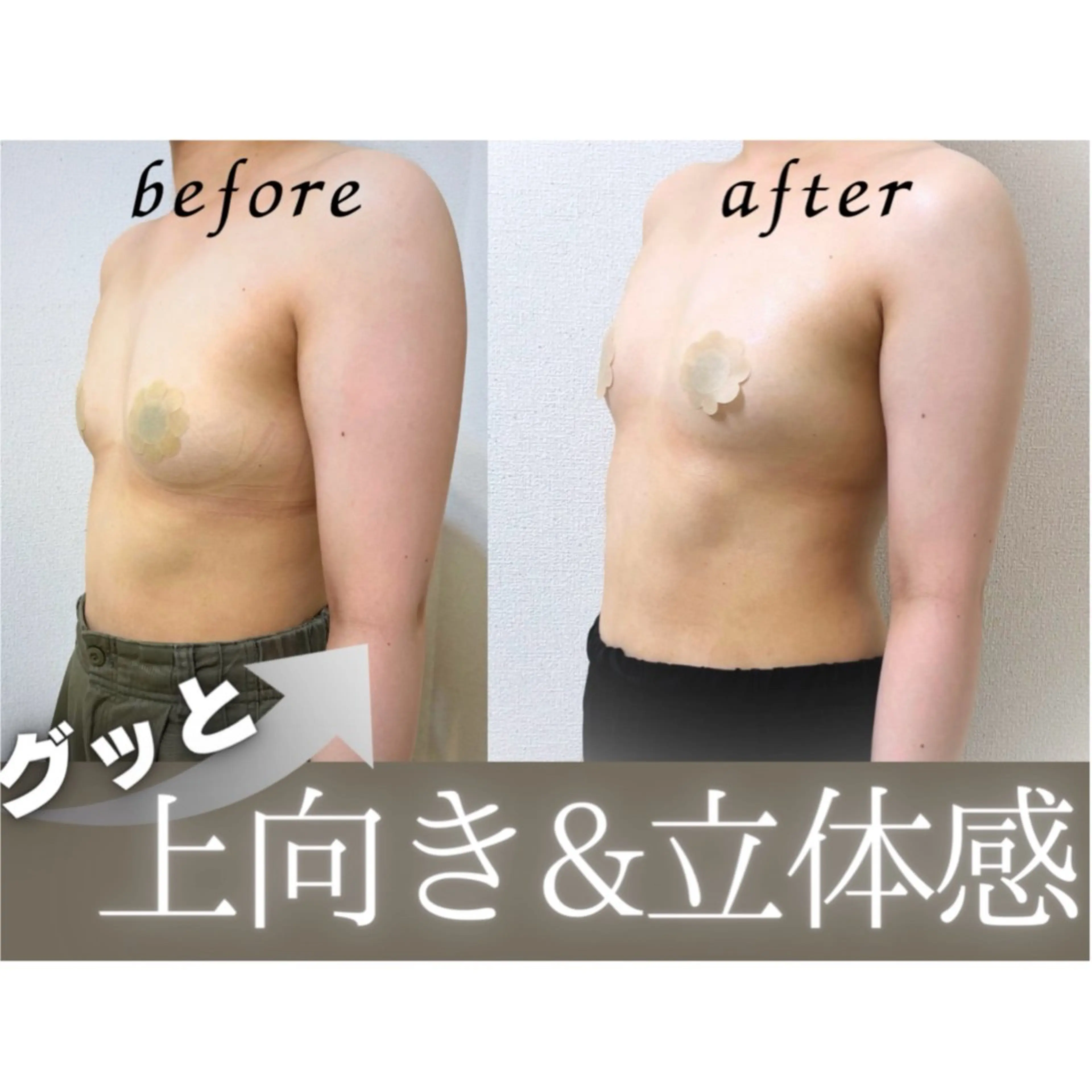 【まずは体験！】上半身集中バストケア《美バスト×肩スッキリ》の写真