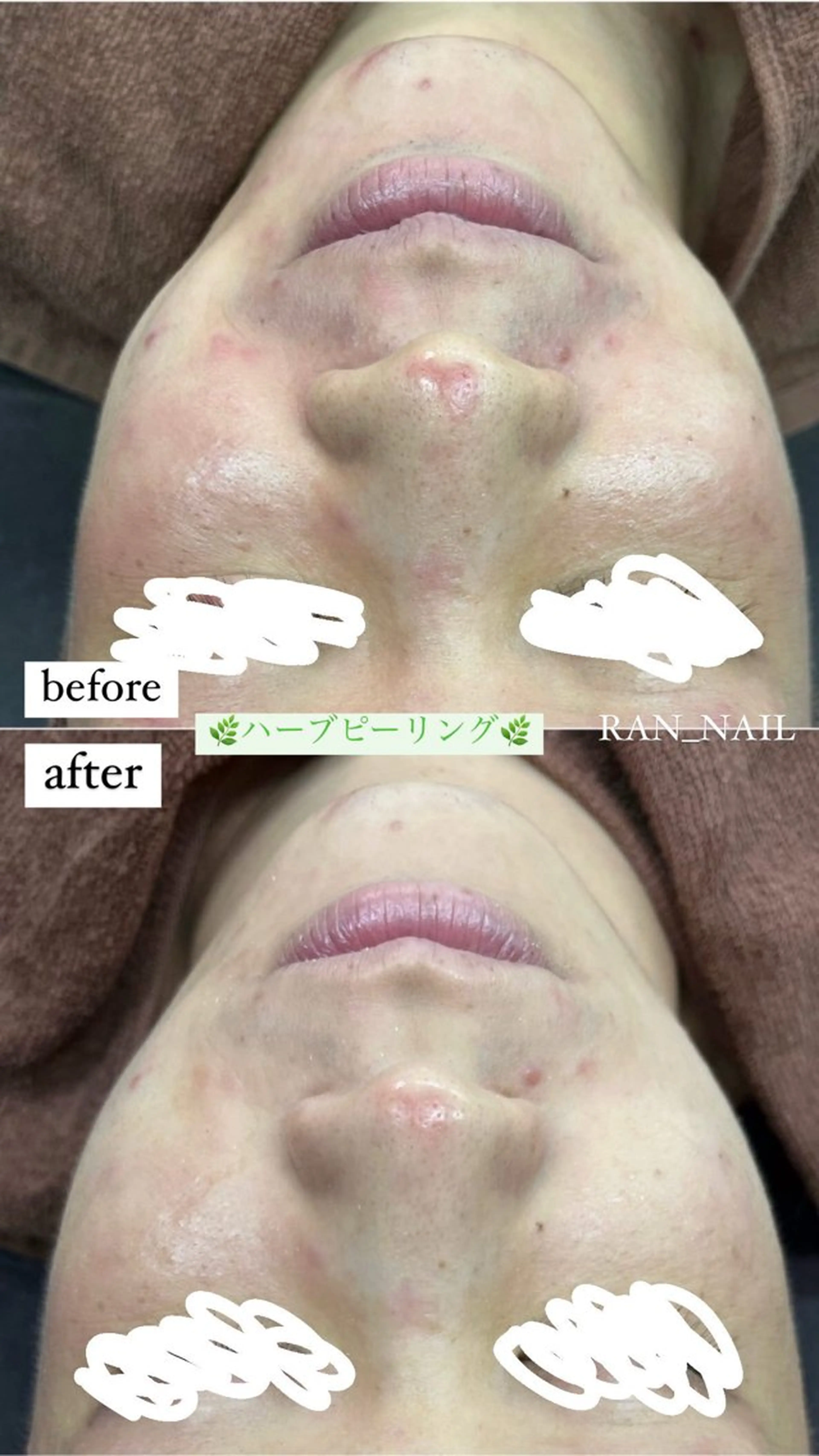 志免町 フェイスシャルエステのエステ・リラクイメージ