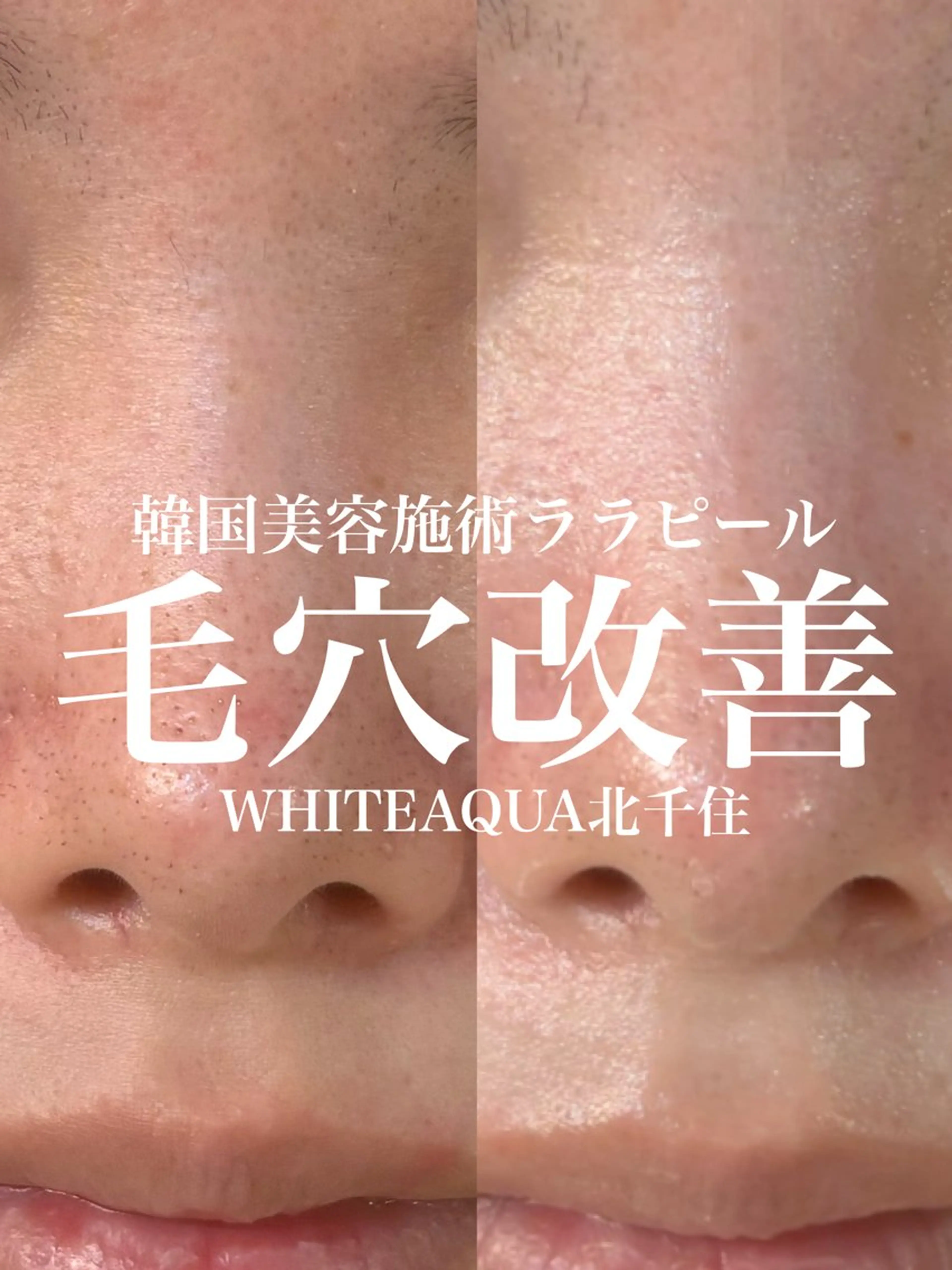 エステ WHITE AQUA 北千住店のエステ・リラクイメージ