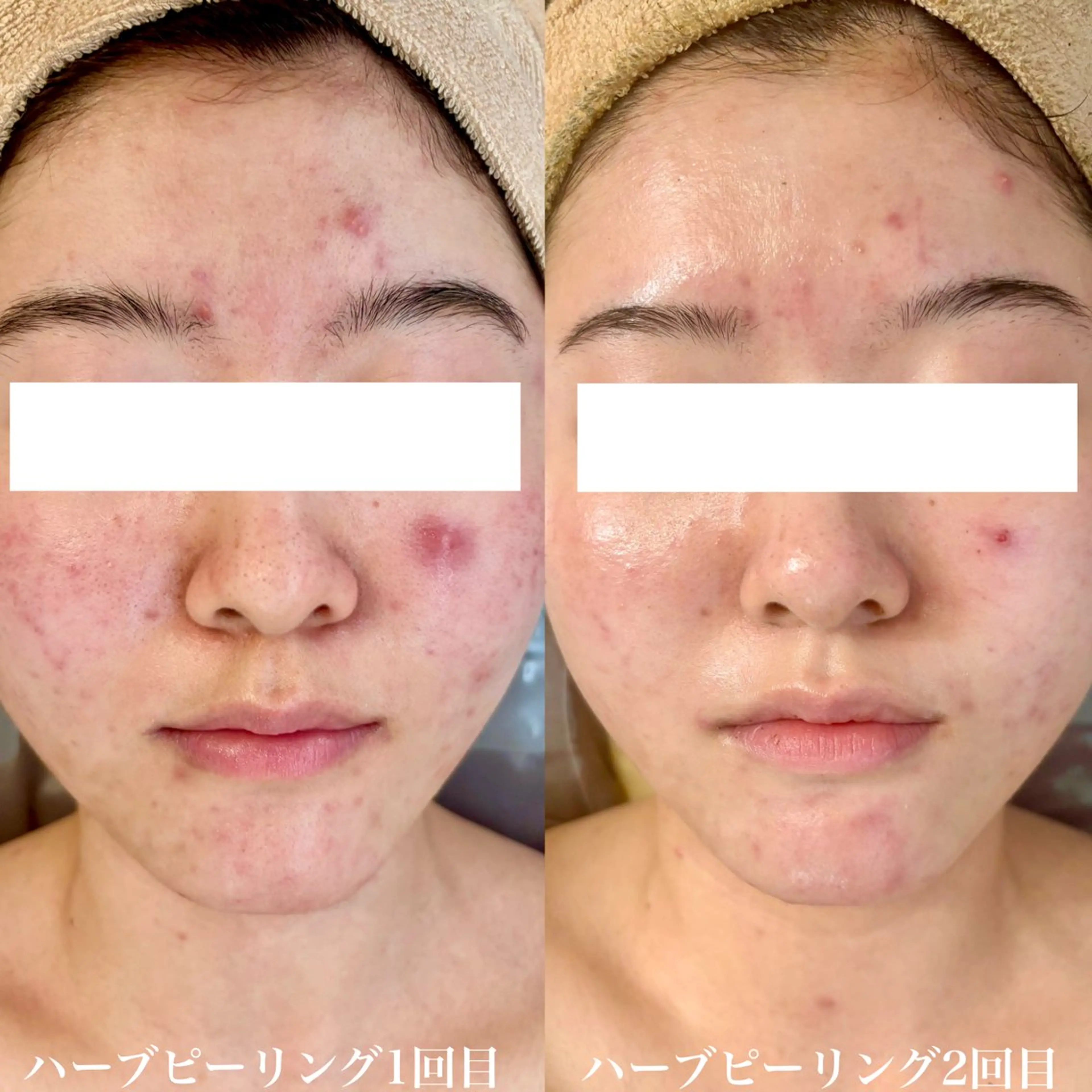 エステ WHITE AQUA 北千住店のエステ・リラクイメージ