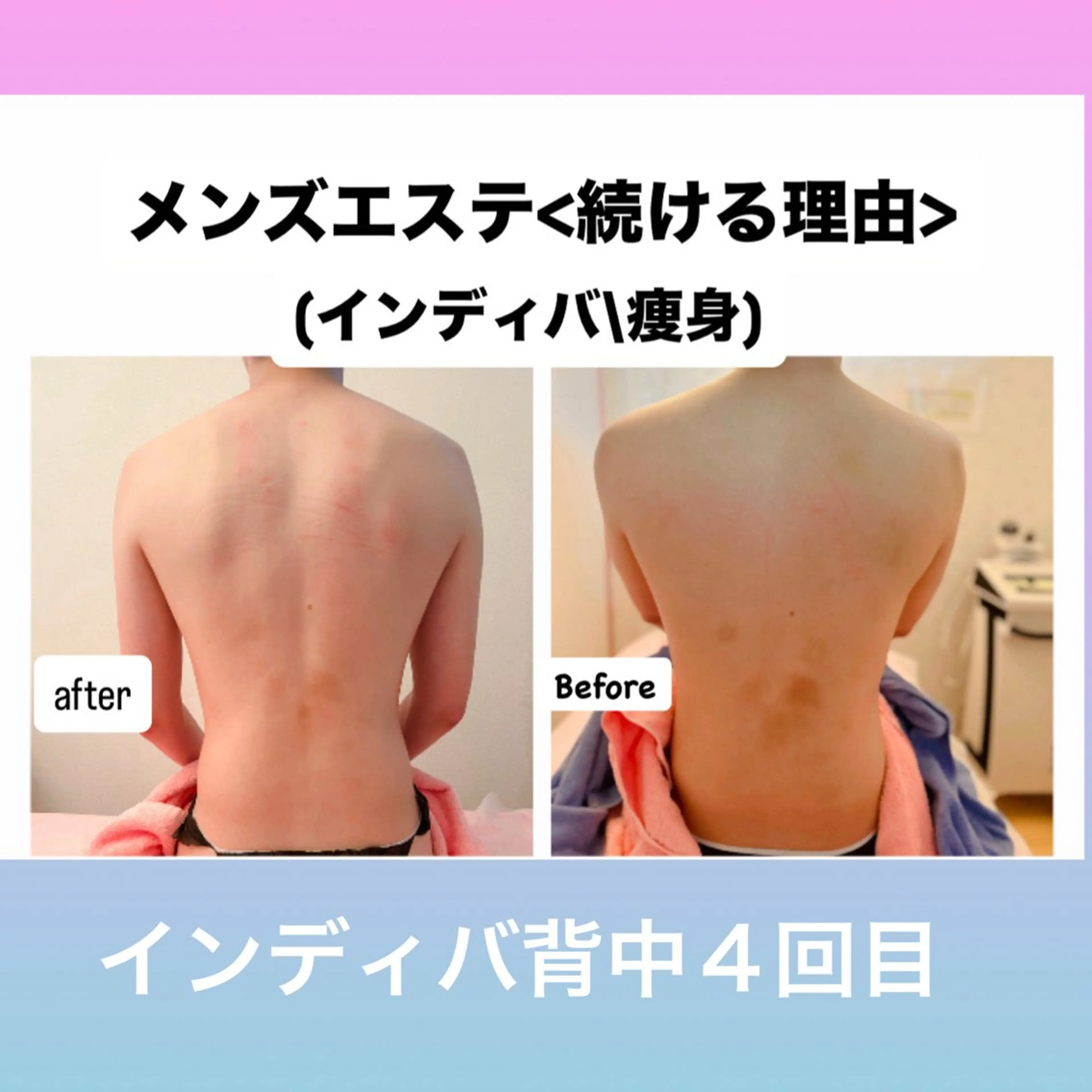 エステ リラク 【ハイパーナイフ痩身&小顔コルギ&ハーブピーリング】K-Beauty　東新宿所属・kーbeauty小顔 コルギ&インディバのエステ・リラクイメージ
