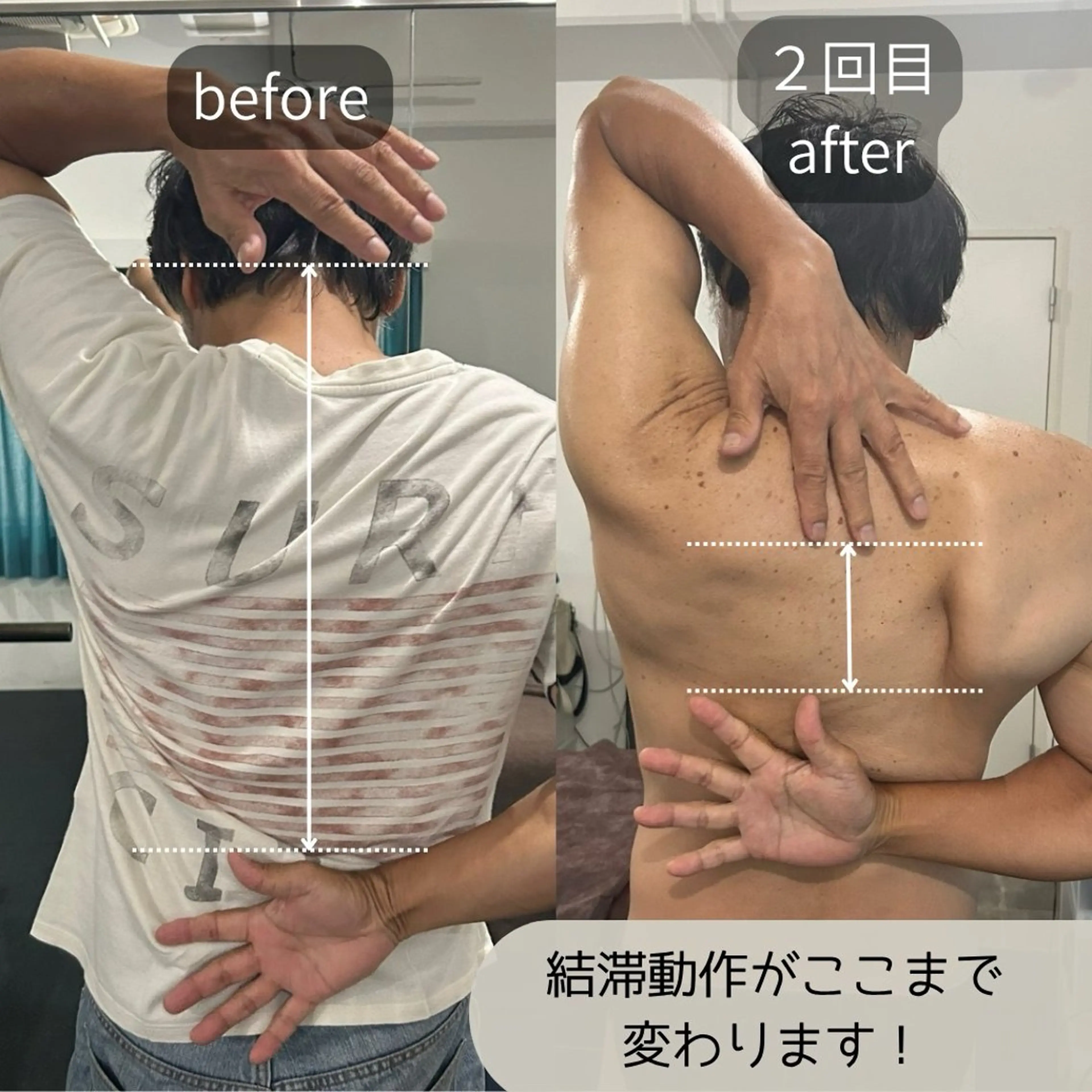 🌱通常メニュー🌱肩甲骨筋膜リリース+小顔リフトアップ/90分◎【肩こり･首こり/むくみ･食いしばり･眼精疲労】🌟の写真