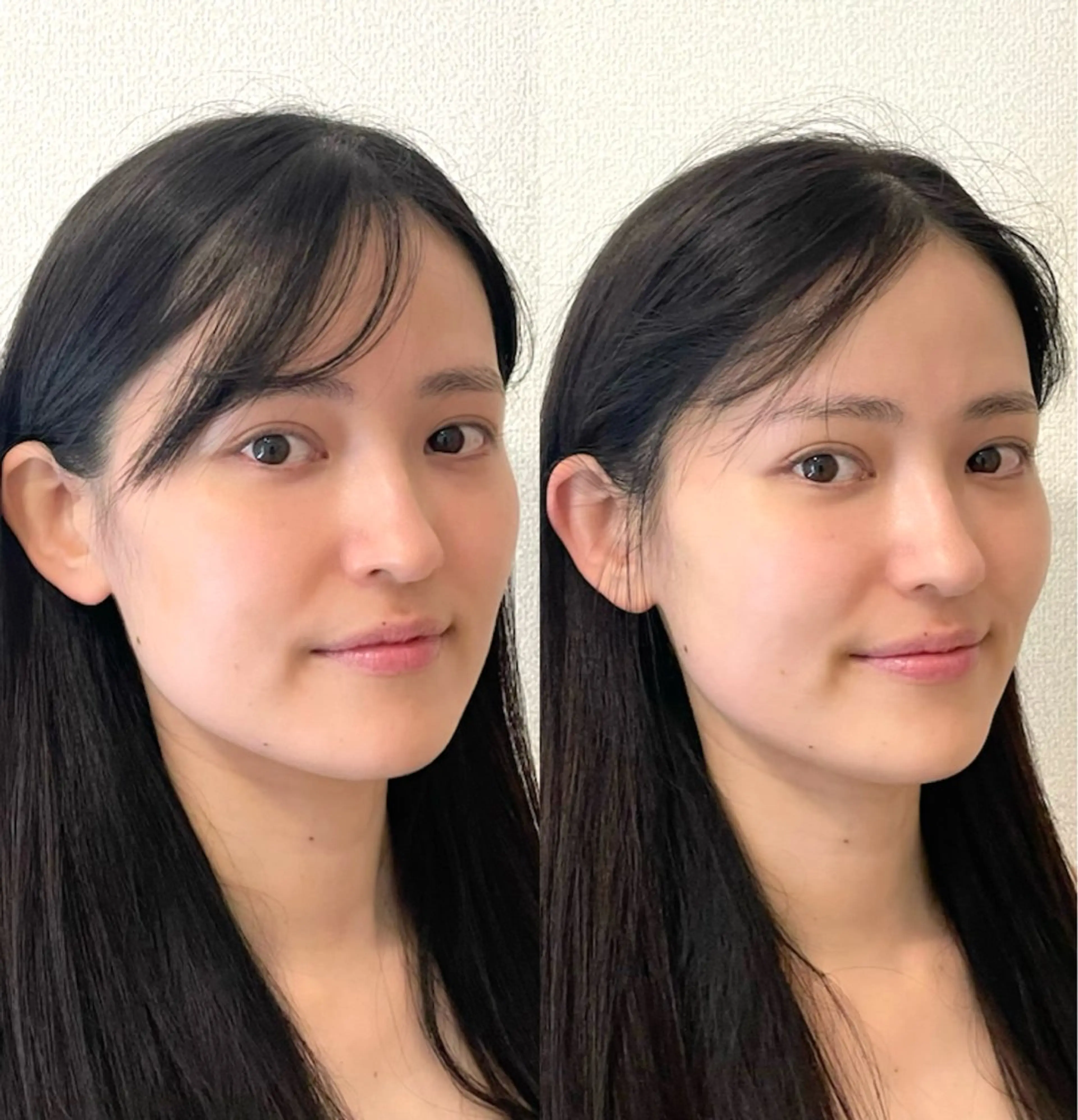 エステ 小顔/たるみ/黒ずみ除去専門サロン/SONA 大和西大寺店所属・【小顔専門看護師 サロンSONA】のエステ・リラクイメージ