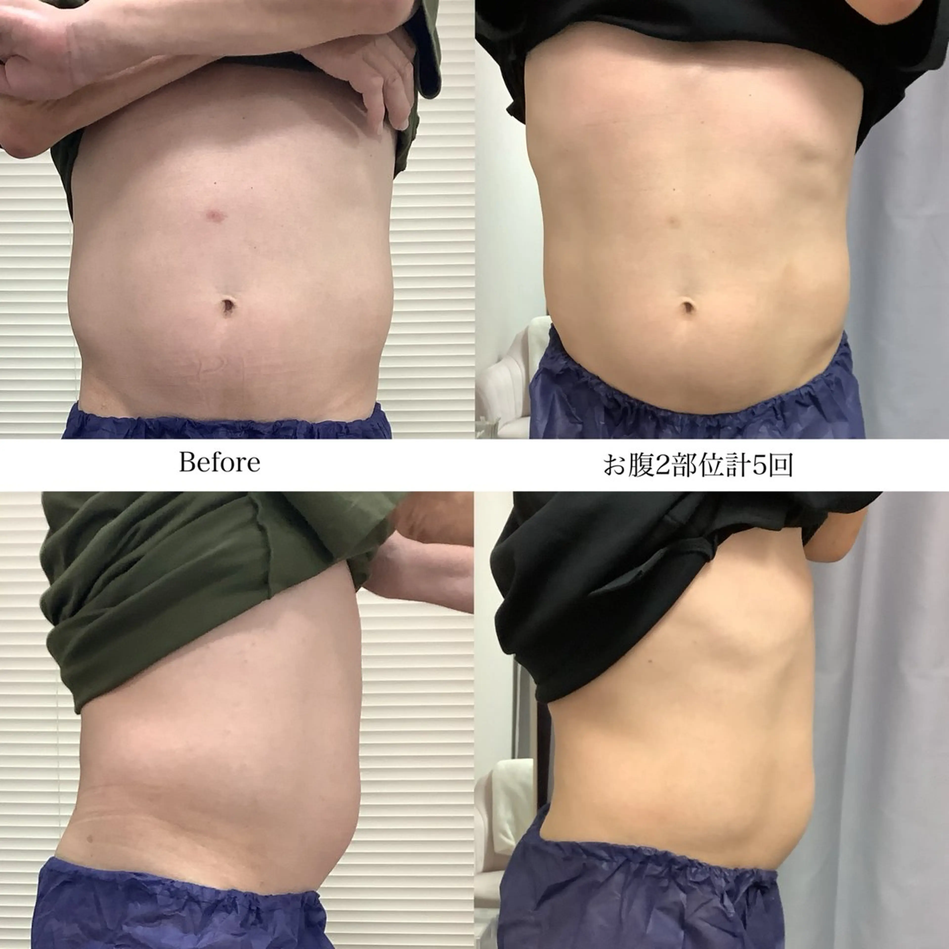 冷却専門店 SLARIのエステ・リラクイメージ