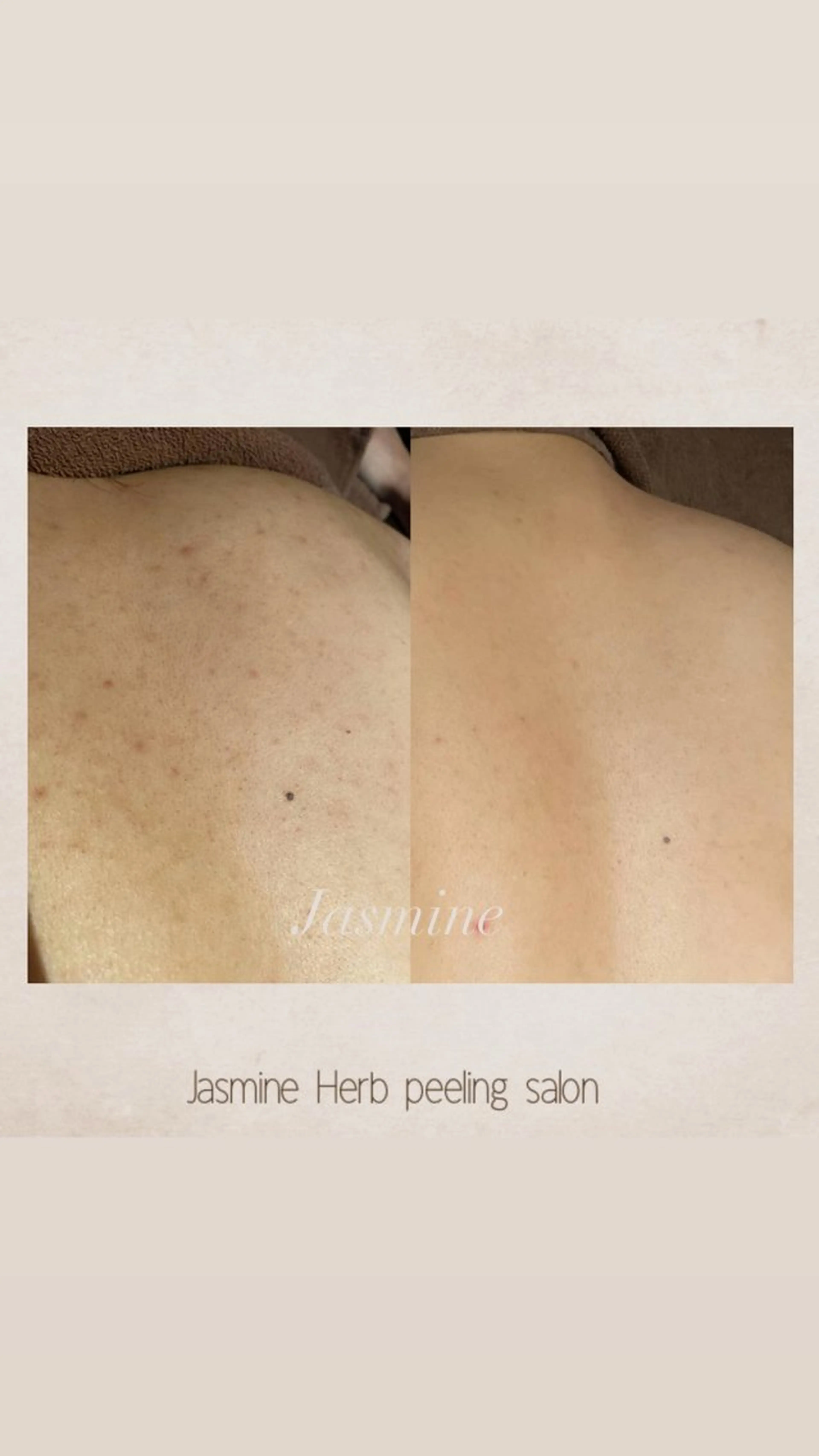 Jasmine所属・Jasmine herbのエステ・リラクイメージ