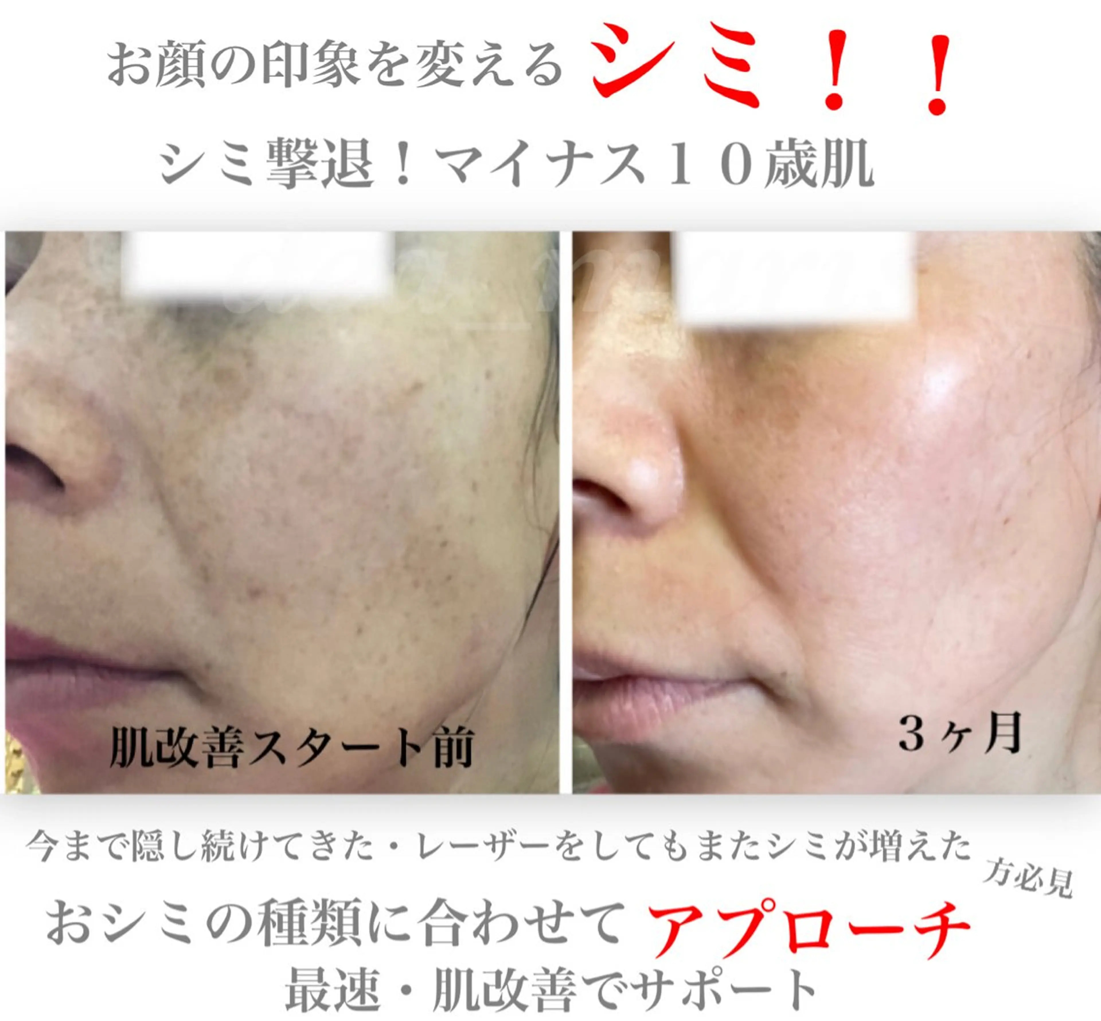 private salon  Dea_maris シュガーリング＆パーソナルボディケア所属・ダイエット難民が通う 10キロダイエットのその他イメージ