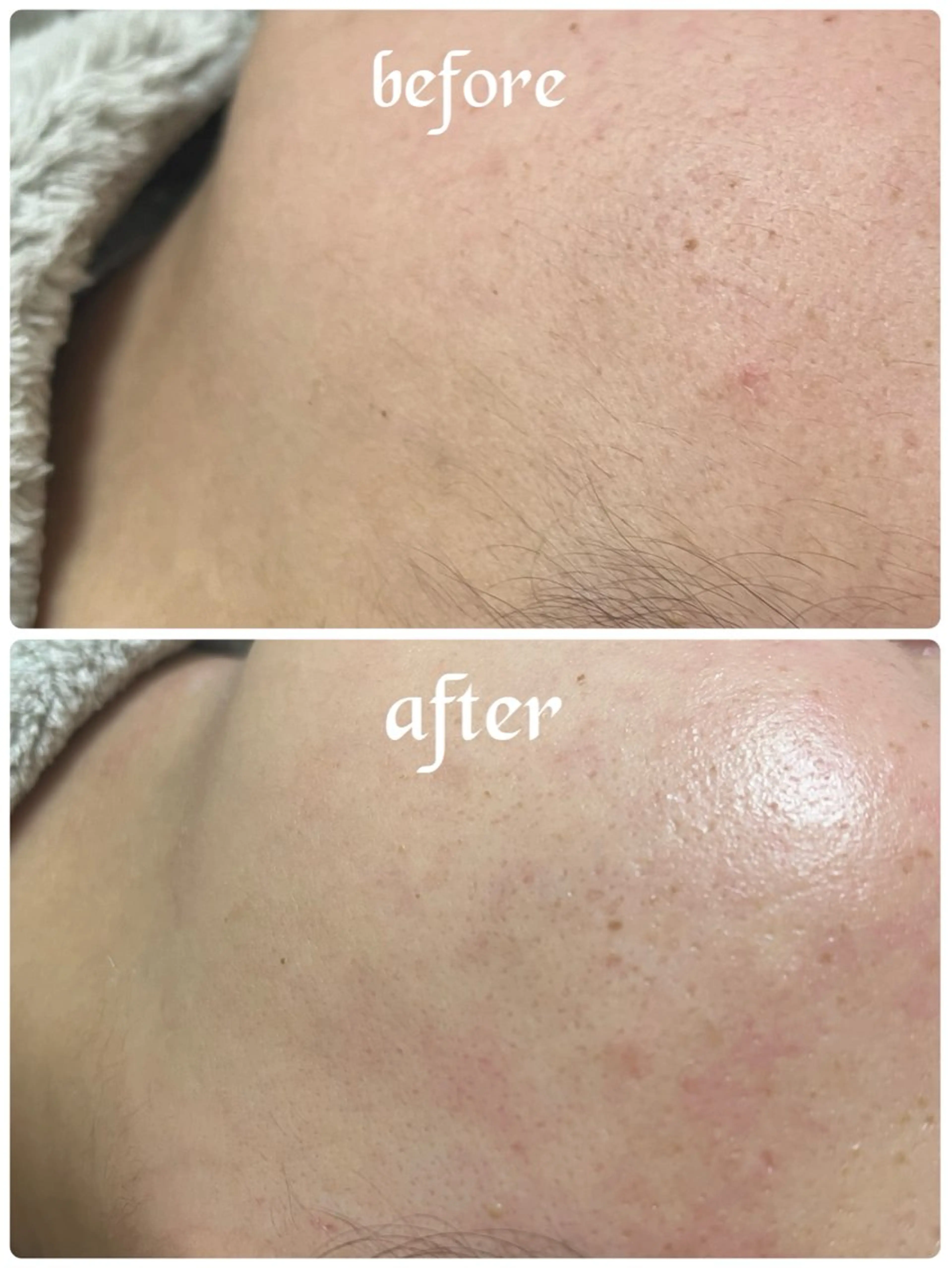 アイブロウ 眉毛ワックス脱毛 脱毛 MAKANA waxing&relaxation所属・MAKANA 吉岡 小岩店のエステ・リラクイメージ