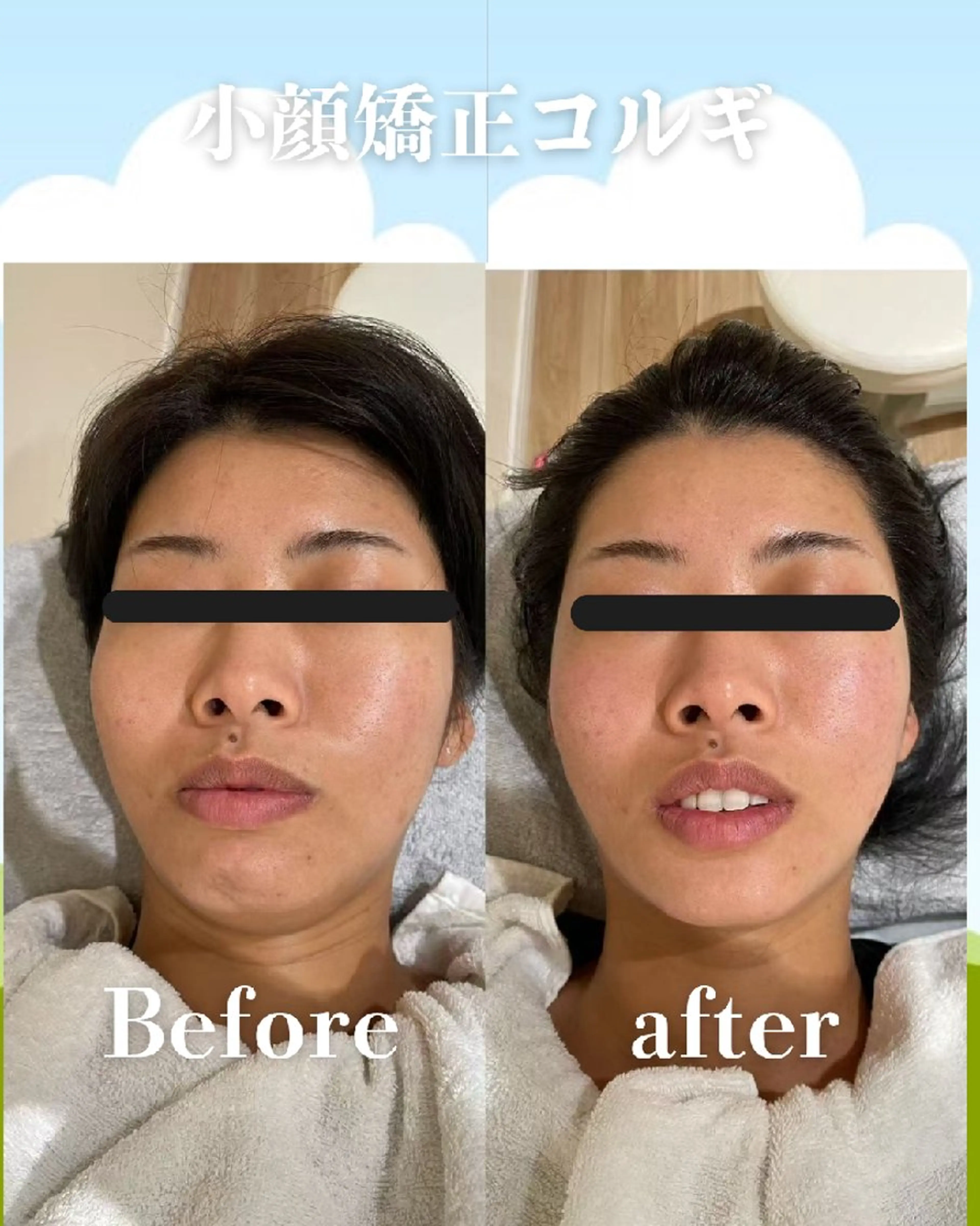 エステ リラク 高岳/久屋大通　脱毛 コルギ🌿ENSHIのエステ・リラクイメージ