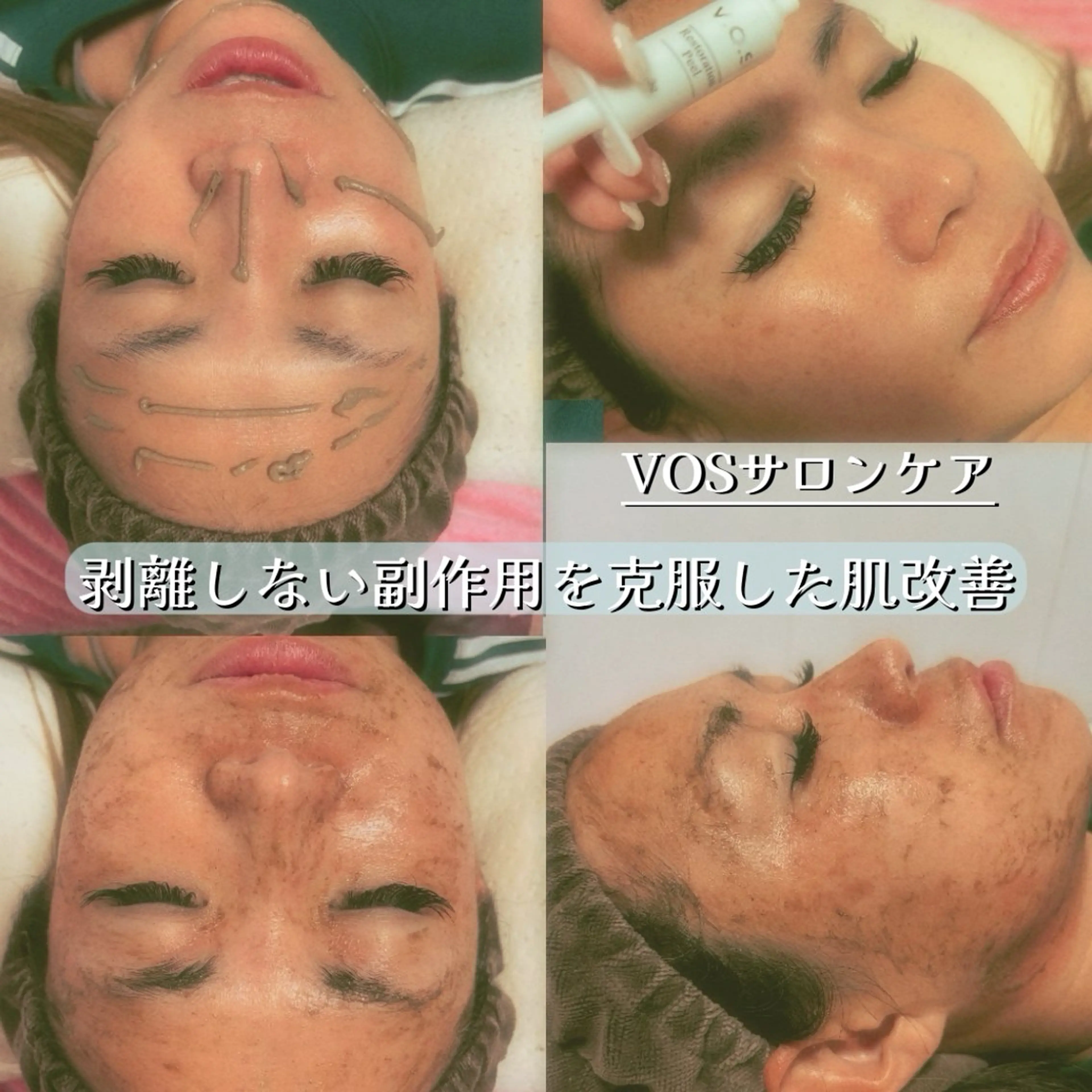 マツエク・マツパ まつげパーマ エステ リラク エステ.まつげ.小顔 眉毛.プラズマ.脱毛のエステ・リラクイメージ