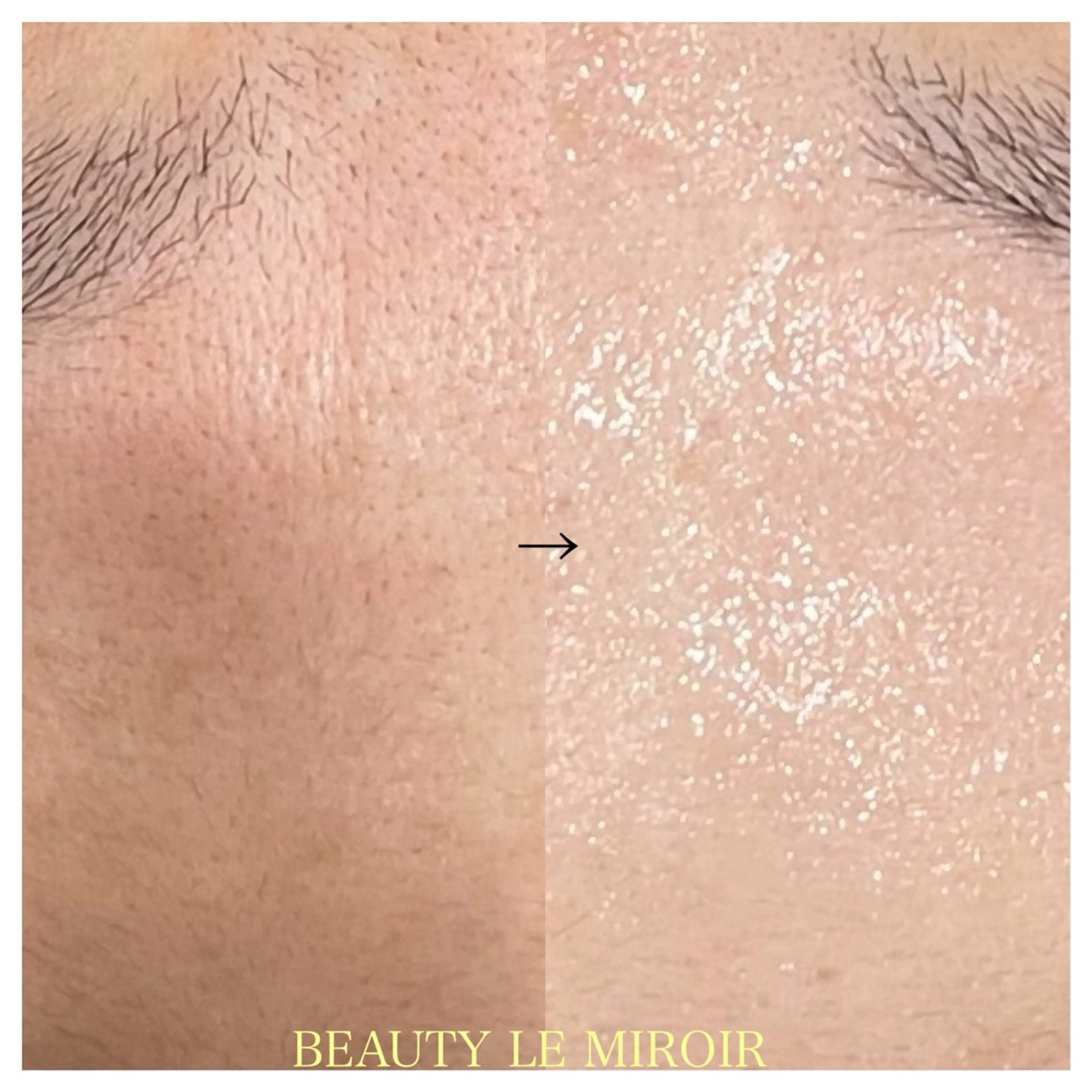 ビューティー ミロワールのエステ・リラクイメージ