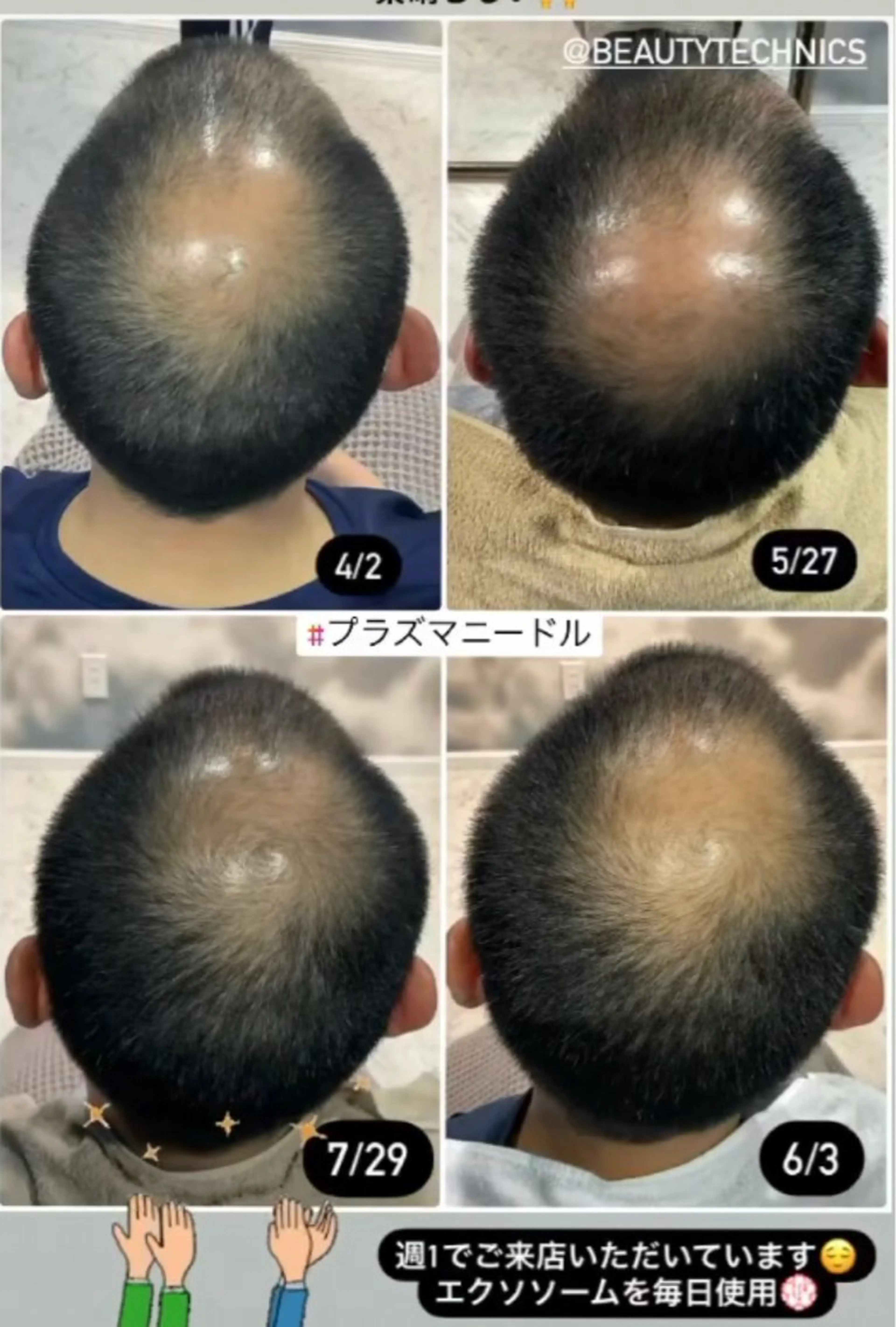 private salon Dea_maris シュガーリング&パーソナルボディケア所属・シミ改善・韓国肌管理 ボディメイク痩身のその他イメージ