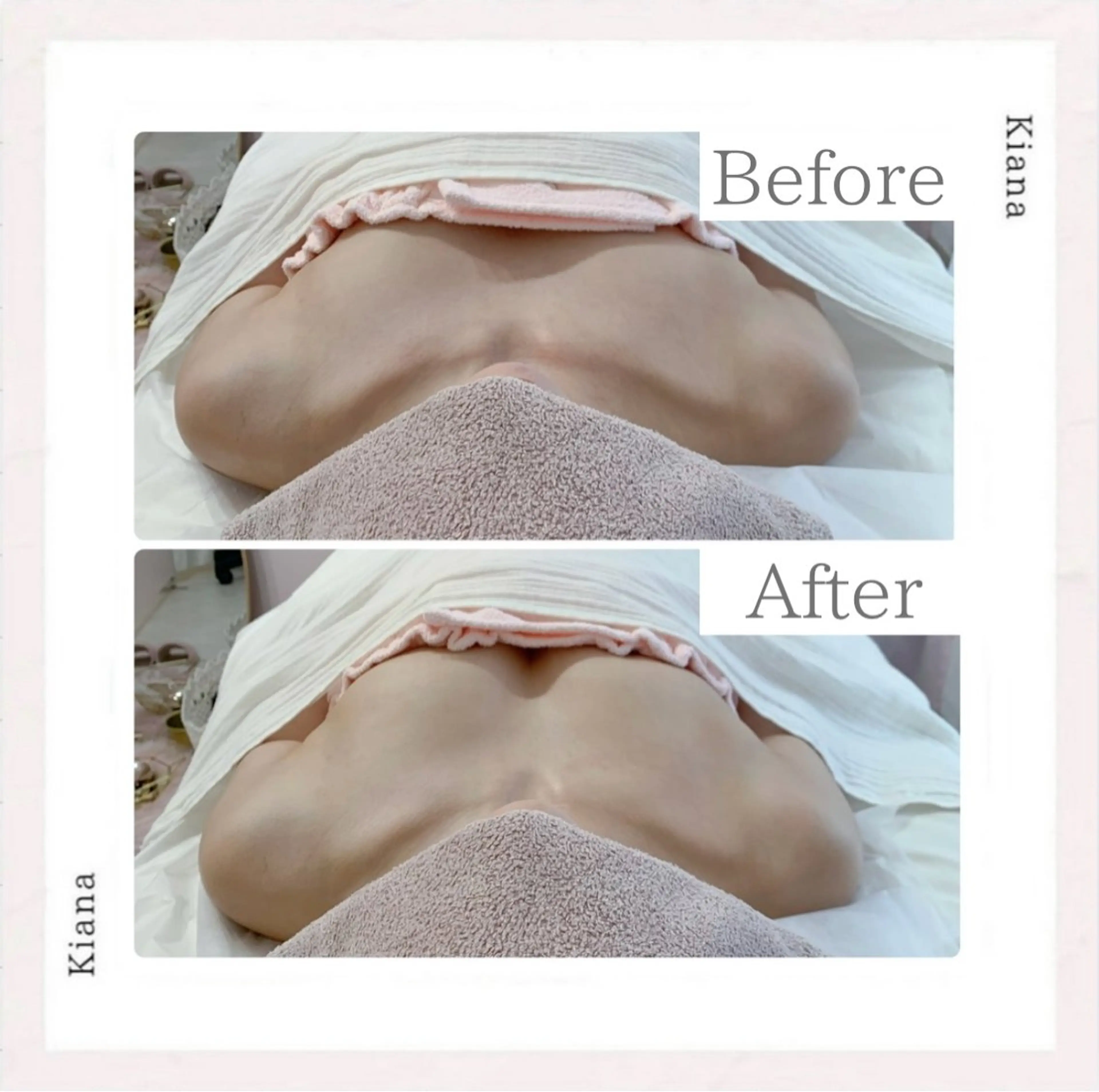 エステ リラク バスト専門Kiana 風のエステ・リラクイメージ