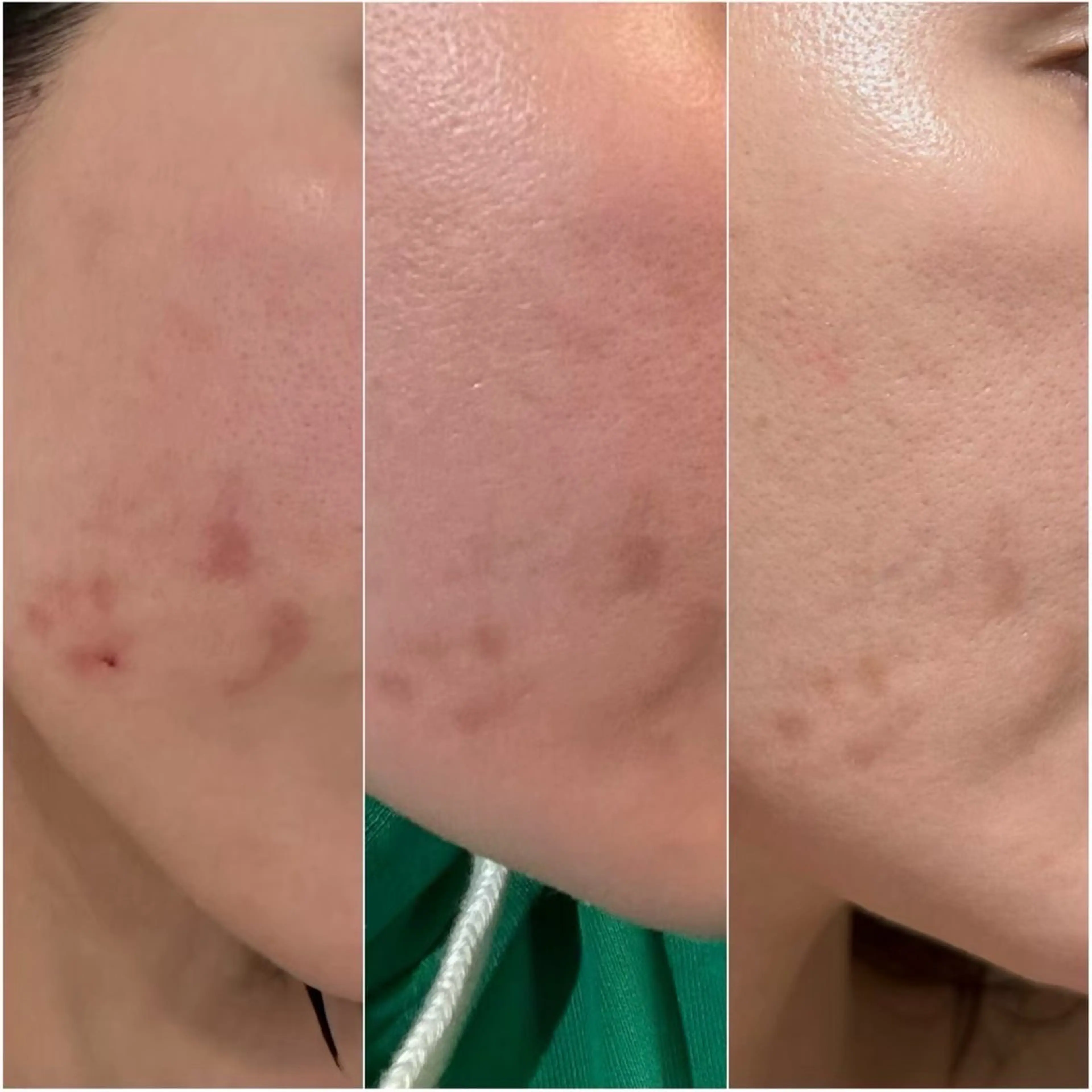 エステ siro スタッフのエステ・リラクイメージ