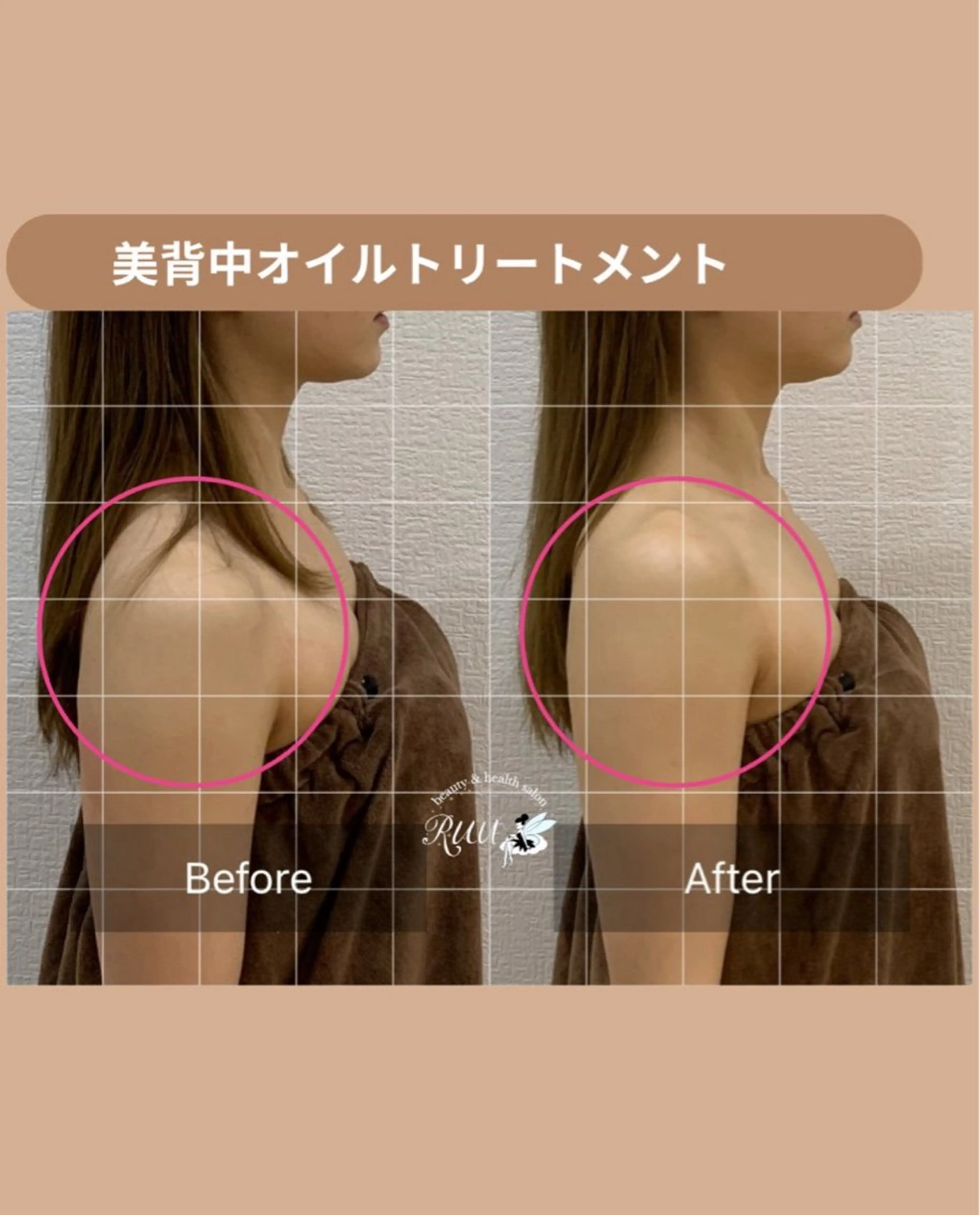 エステ リラク 【頭痛、睡眠改善】 salon RUUのエステ・リラクイメージ