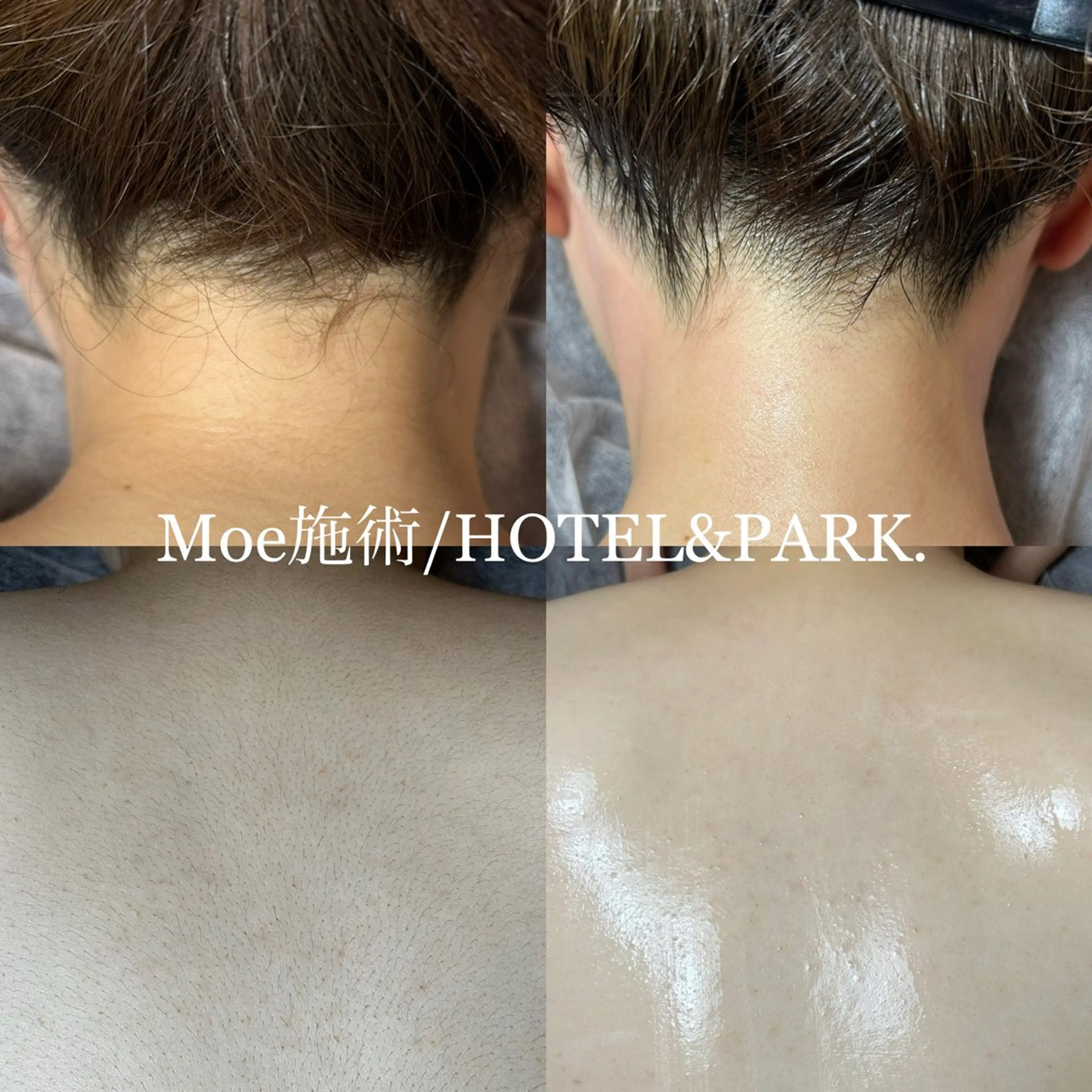 脱毛 HOTEL&PARK .Moeワックス脱毛のエステ・リラクイメージ