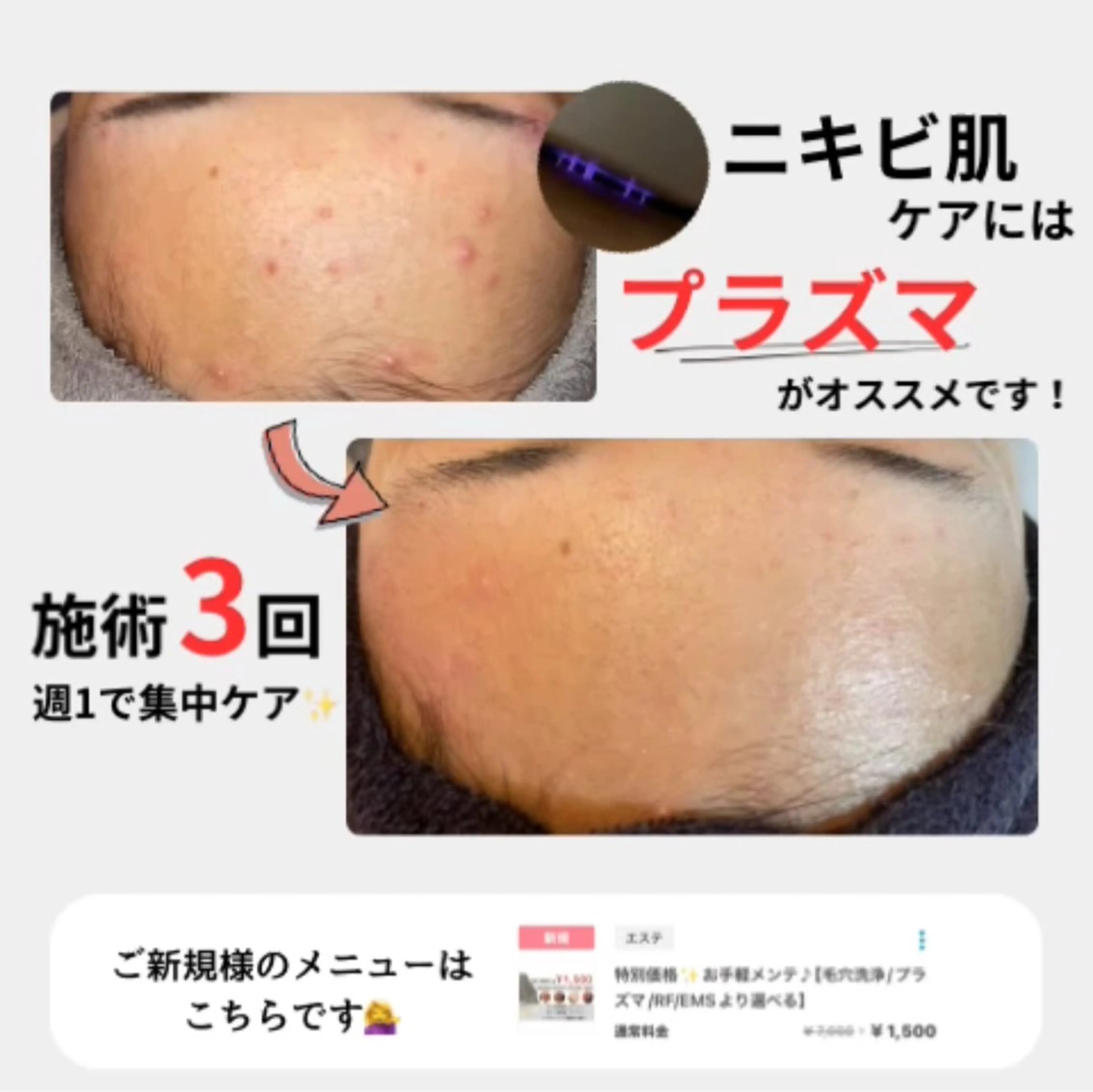 エステ Babel 〜都度払いサロン〜のエステ・リラクイメージ