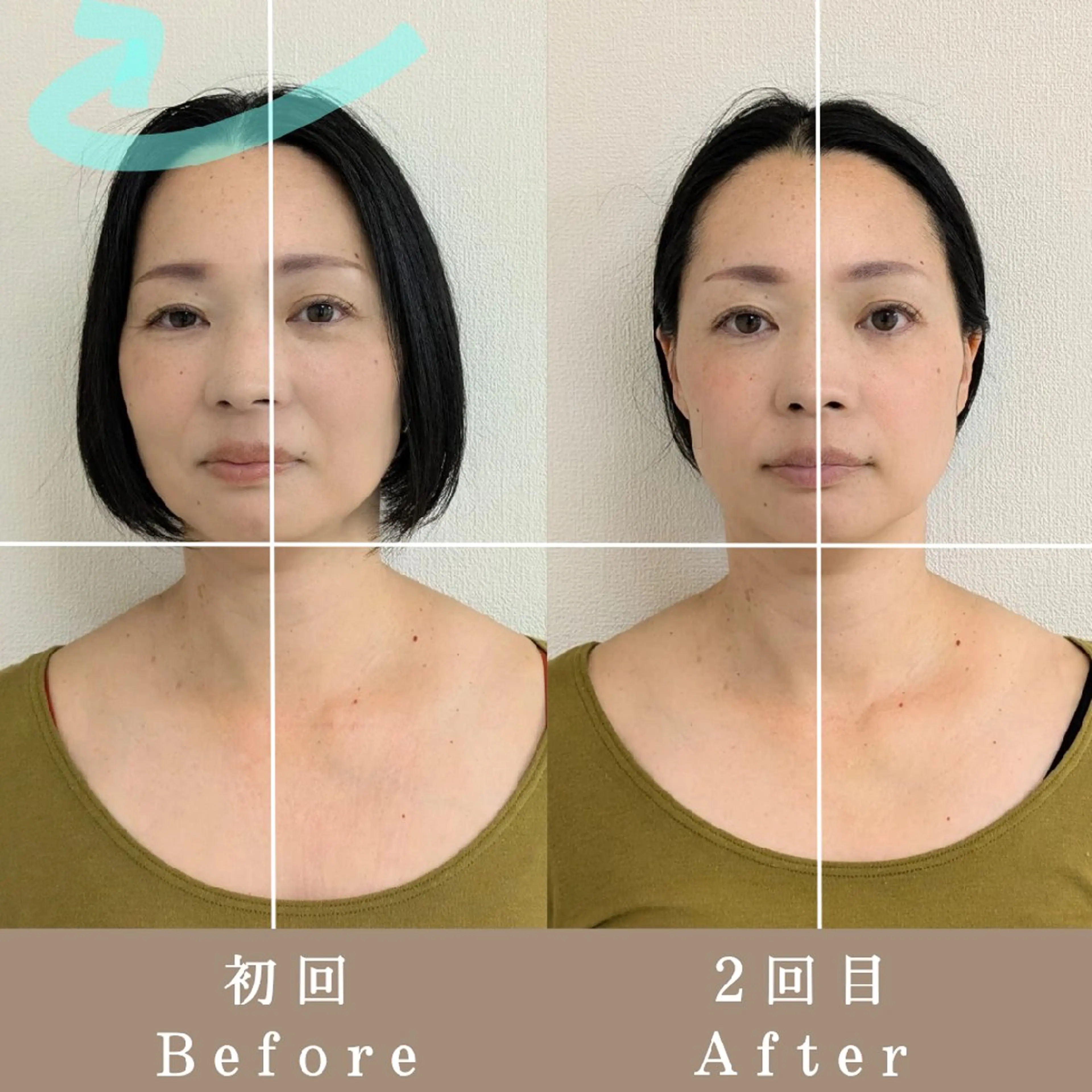 ✨️お顔の印象が変わる✨️整顔ベーシック40分💆お顔のお悩みだけでなく自律神経にも😌の写真