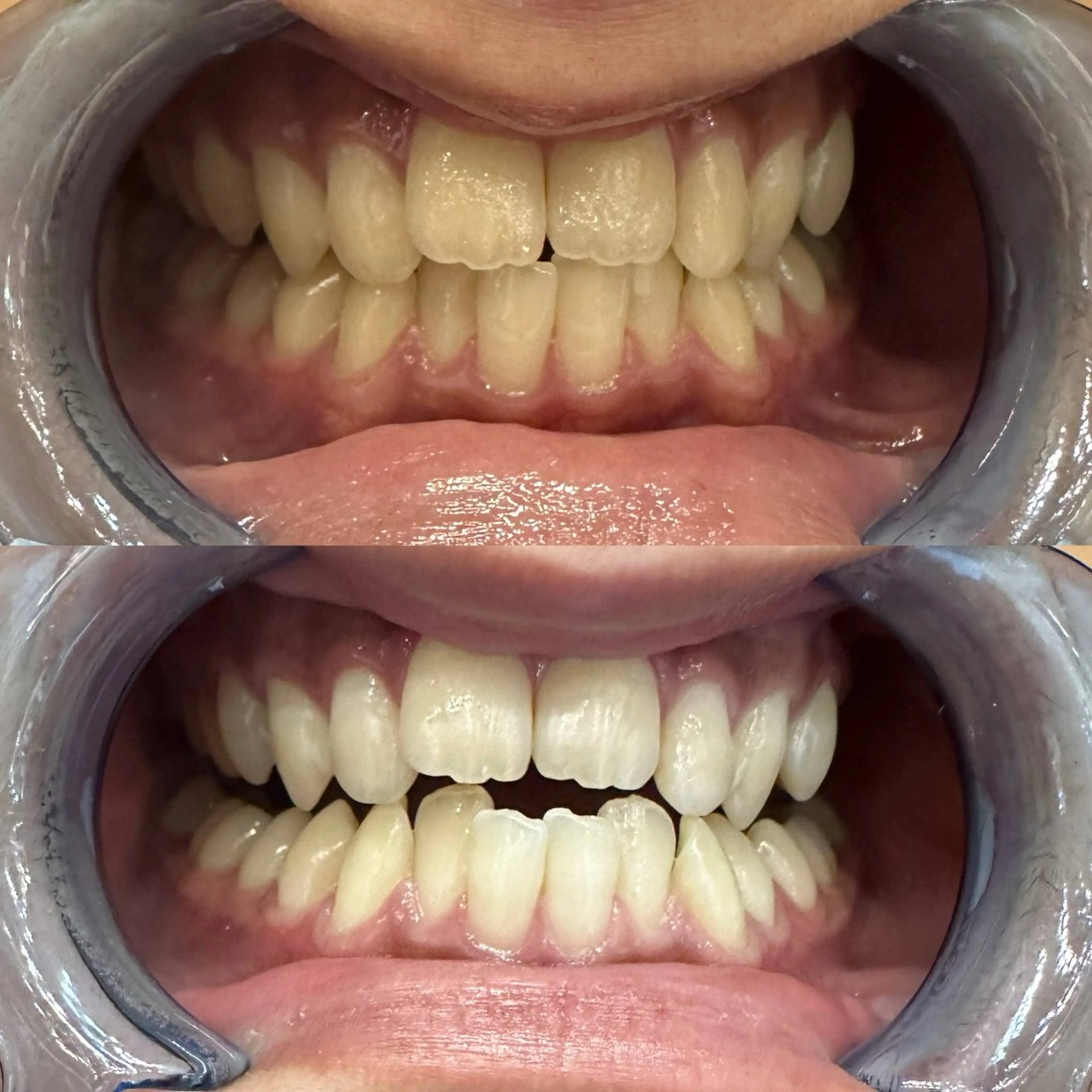 ホワイトニングサロンaile所属・セルフホワイトニング 金城しおりのその他イメージ