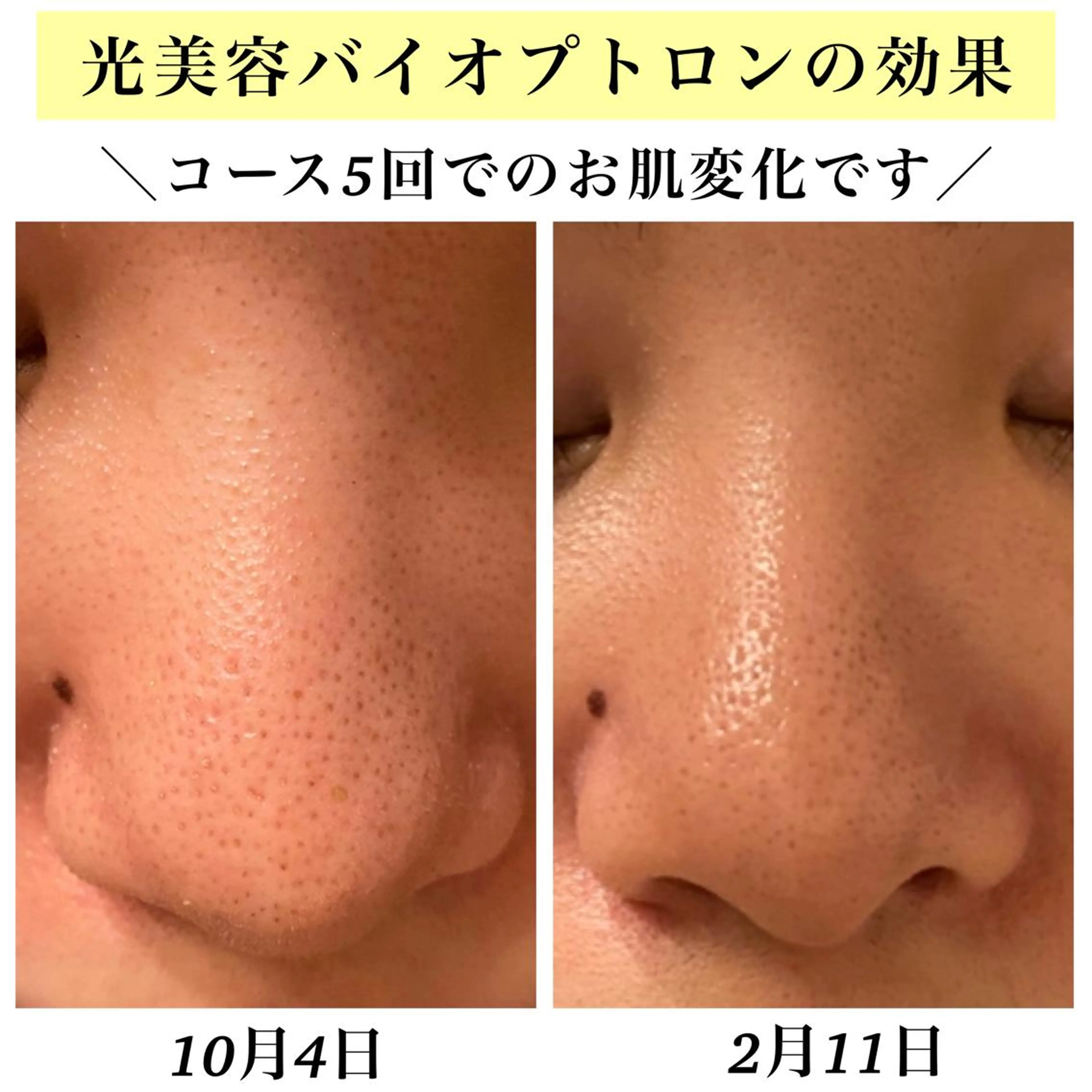 エステ リラク Bellesthe （ベルエステ）のエステ・リラクイメージ