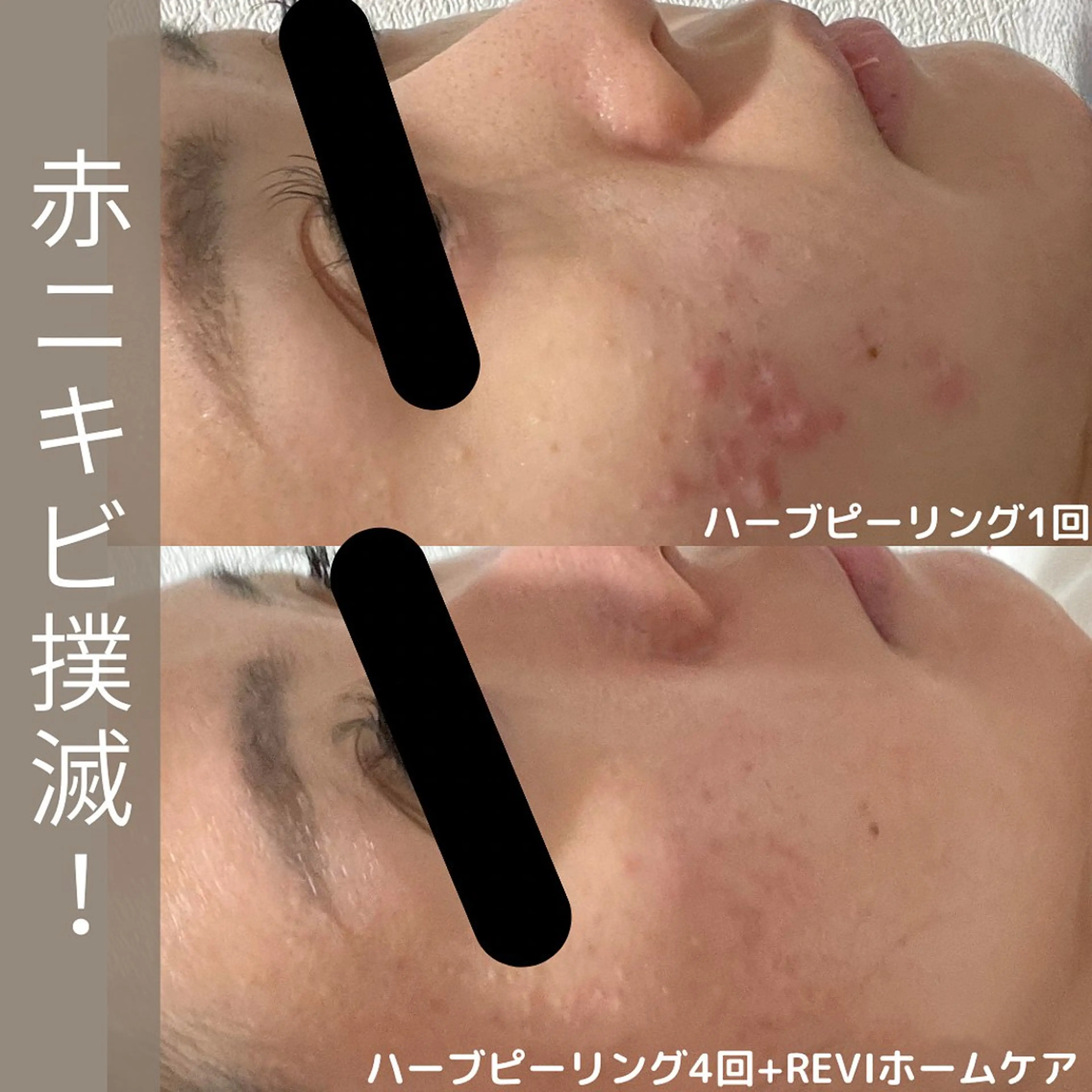小林 千紘のエステ・リラクイメージ
