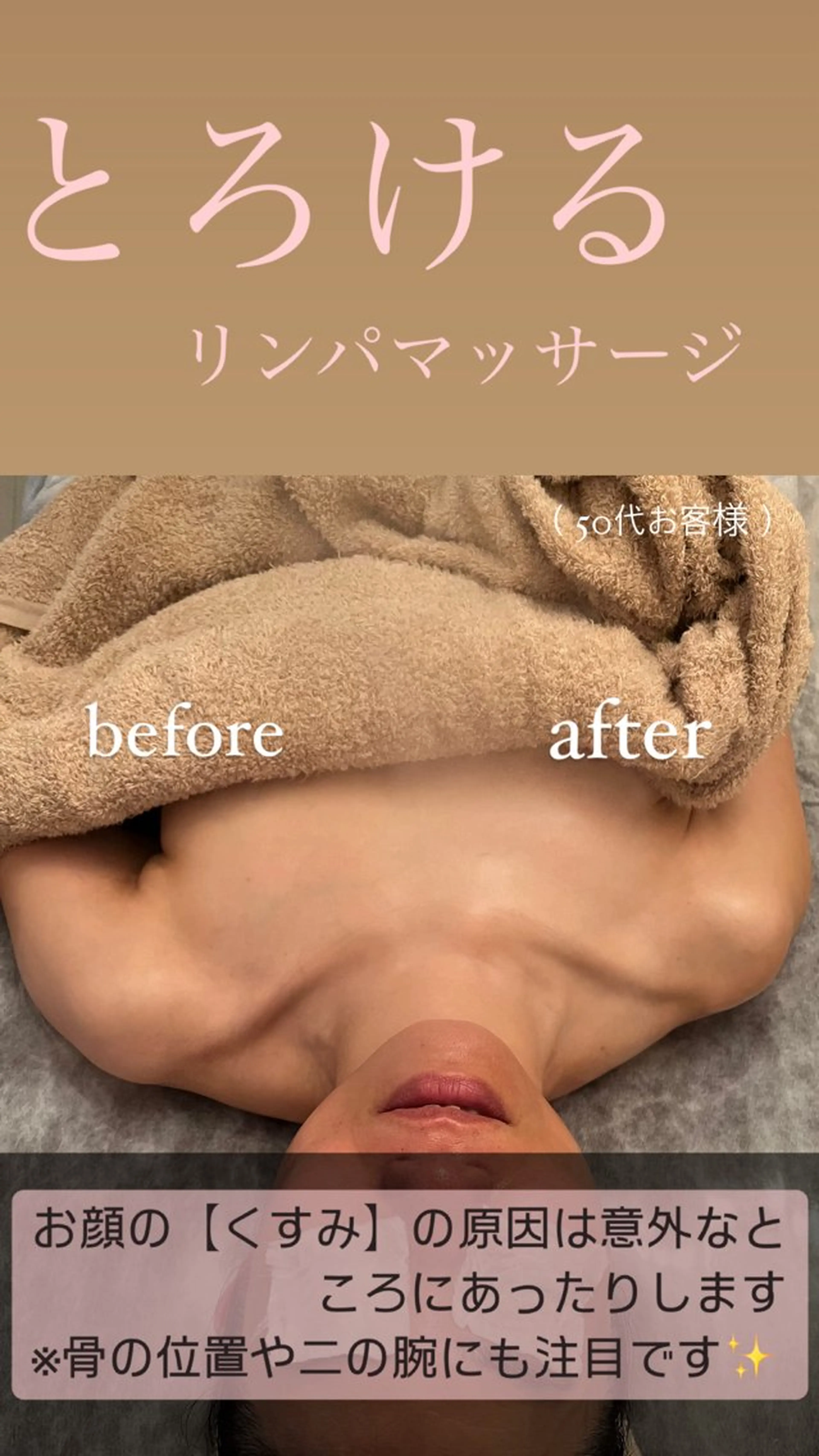【天神】毛穴・インデ ィバ・ボディケアのエステ・リラクイメージ