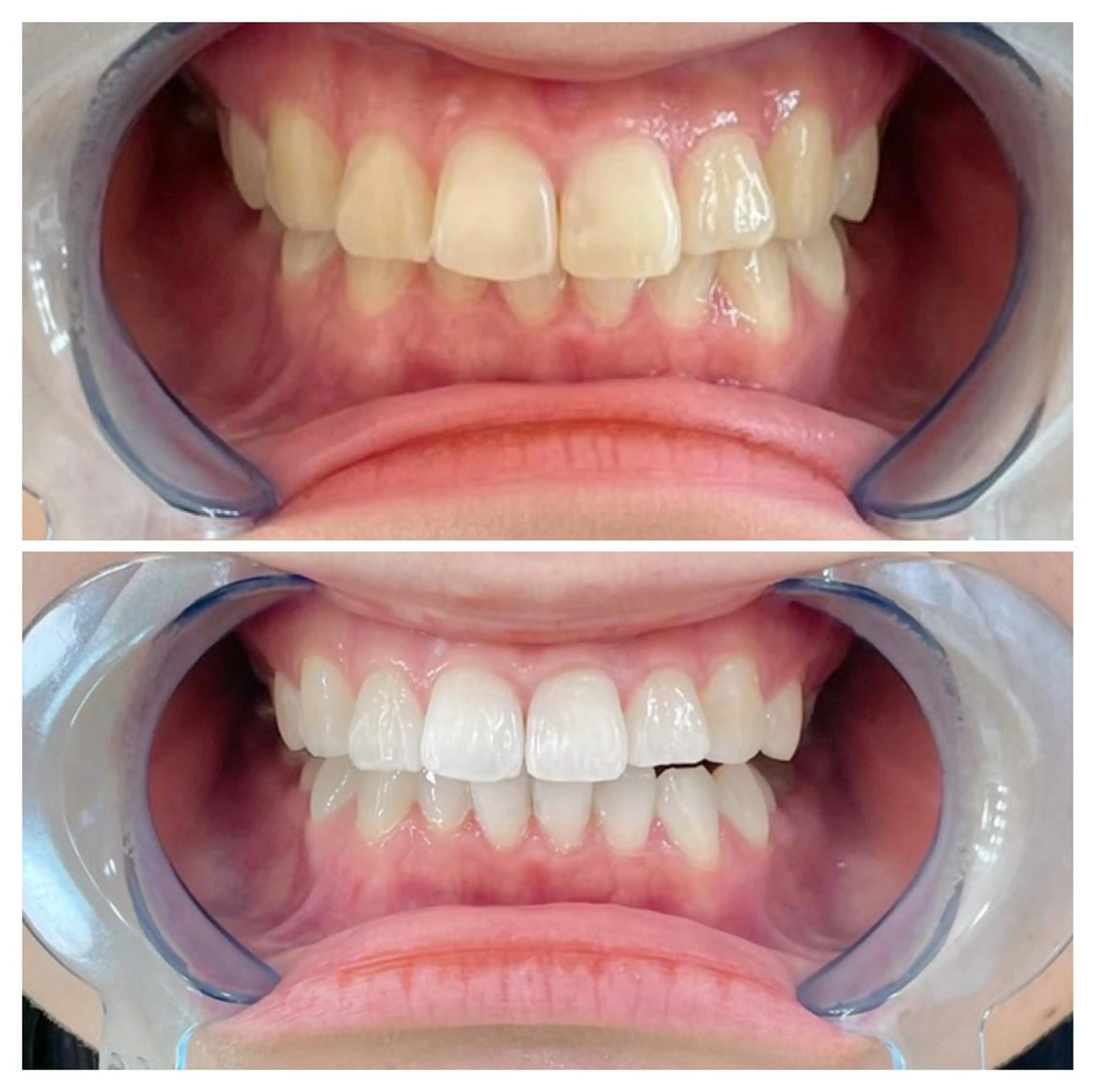 ロング ヘアアレンジ ネイル マツエク・マツパ メンズ カラー パーマ キッズ アイブロウ エステ リラク ライトビューティー 銀座店のエステ・リラクイメージ