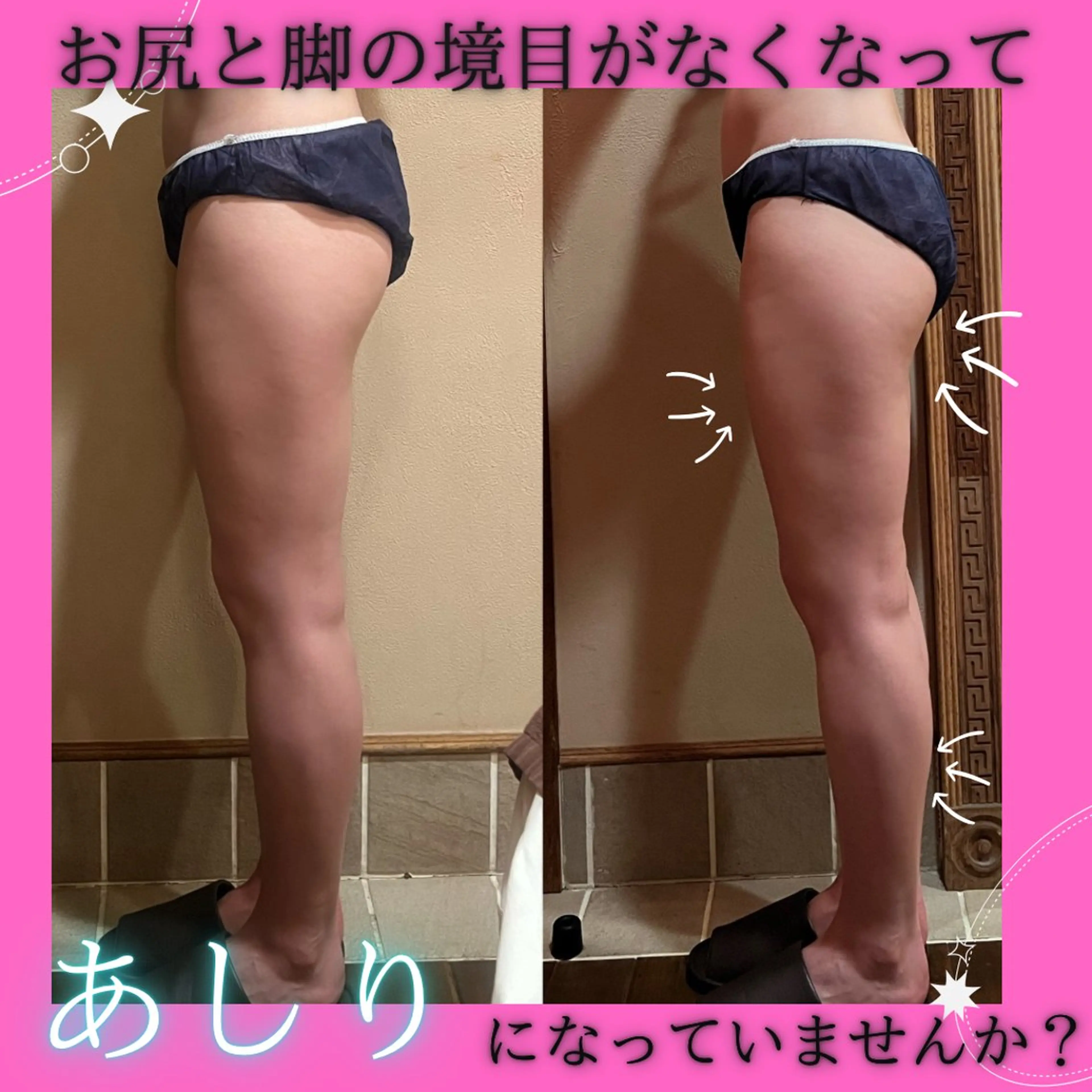 その他 痩身&美肌サロン 堀米✨のエステ・リラクイメージ