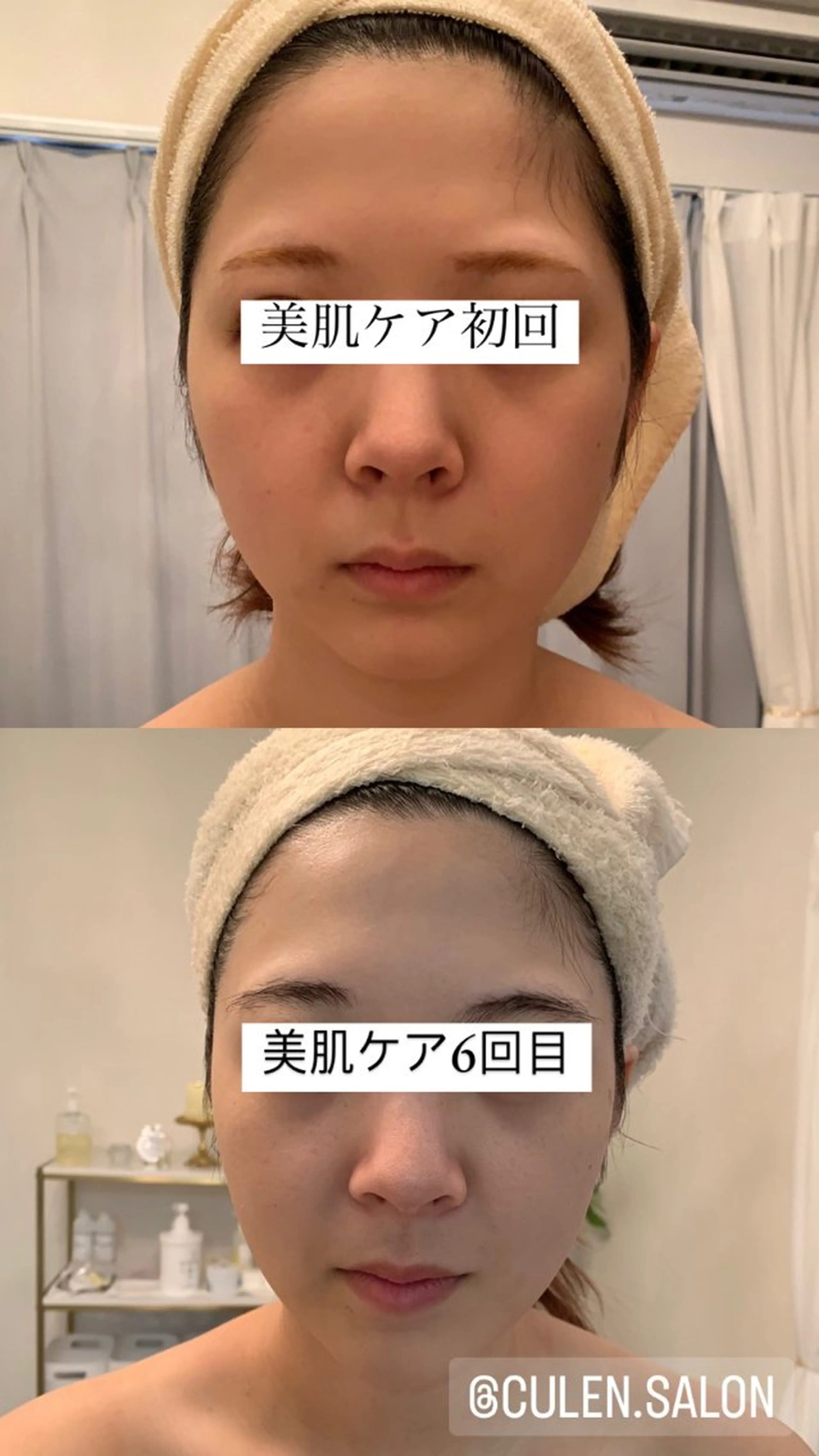 【天神】毛穴・インデ ィバ・ボディケアのエステ・リラクイメージ