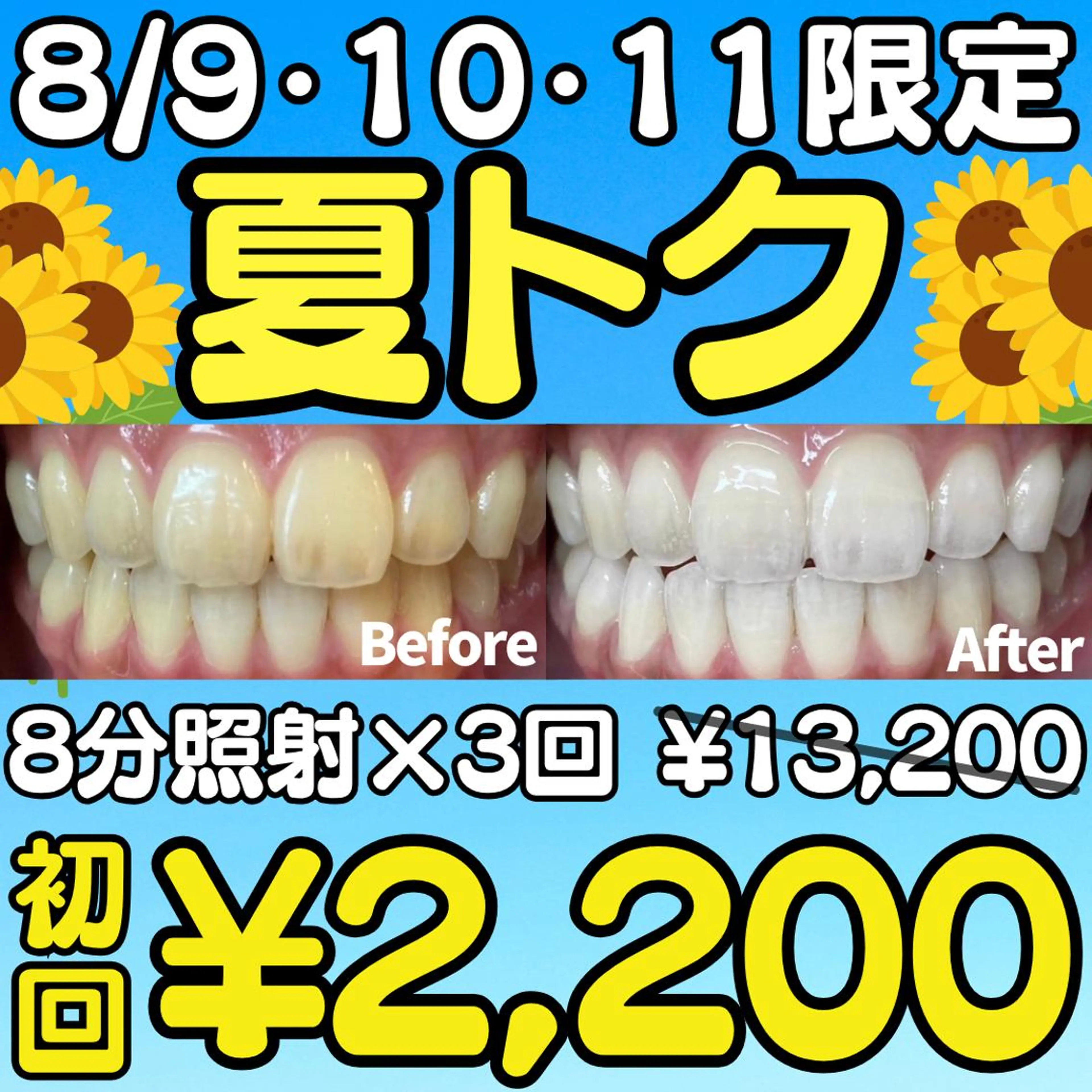 【8/9・10・11日限定🌺夏トク🌺】1回照射プレゼント🎁合計8分照射×3回のセルフホワイトニングで白い歯に🌟の写真