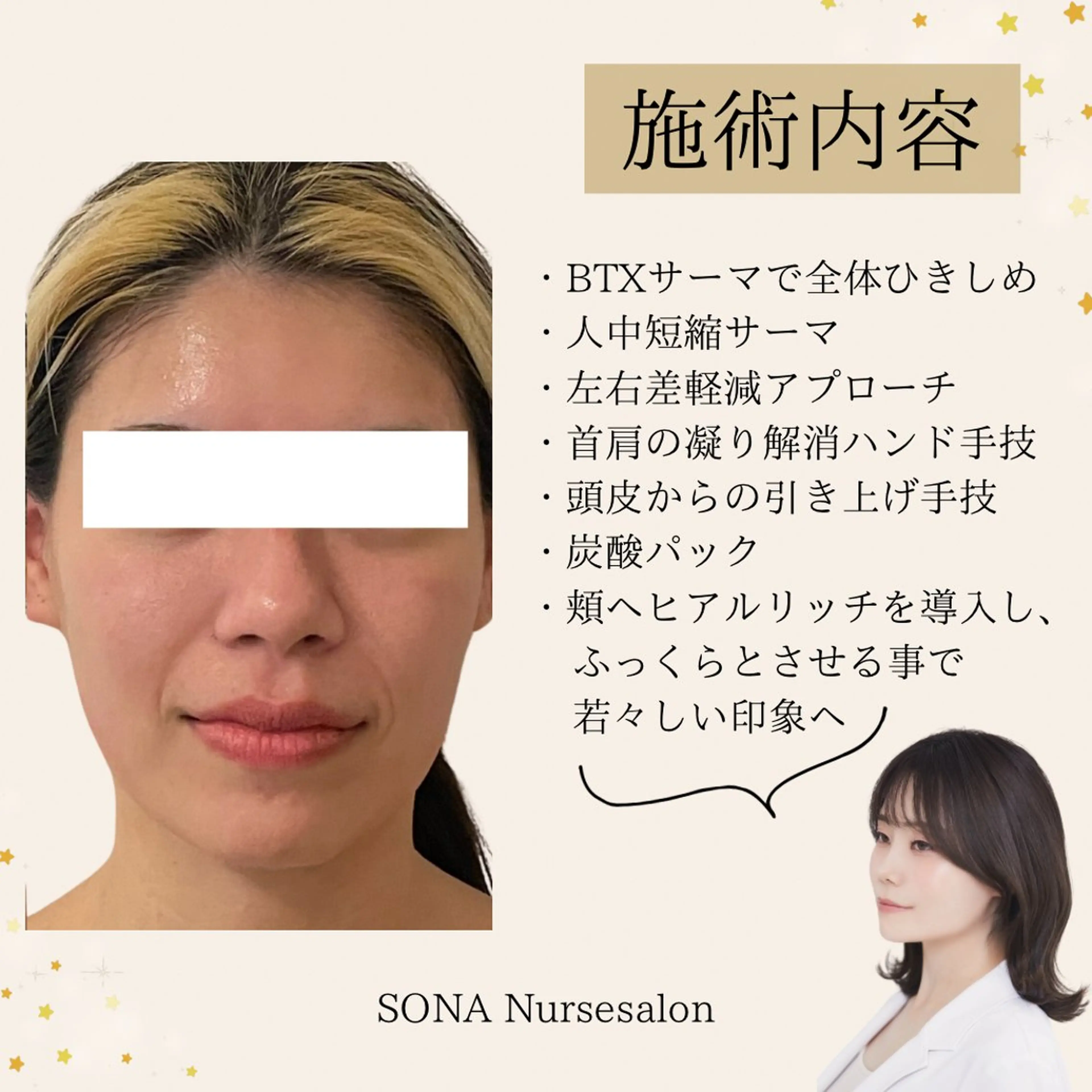 エステ 小顔/たるみ/黒ずみ除去専門サロン/SONA 大和西大寺店所属・【小顔専門看護師 サロンSONA】のエステ・リラクイメージ