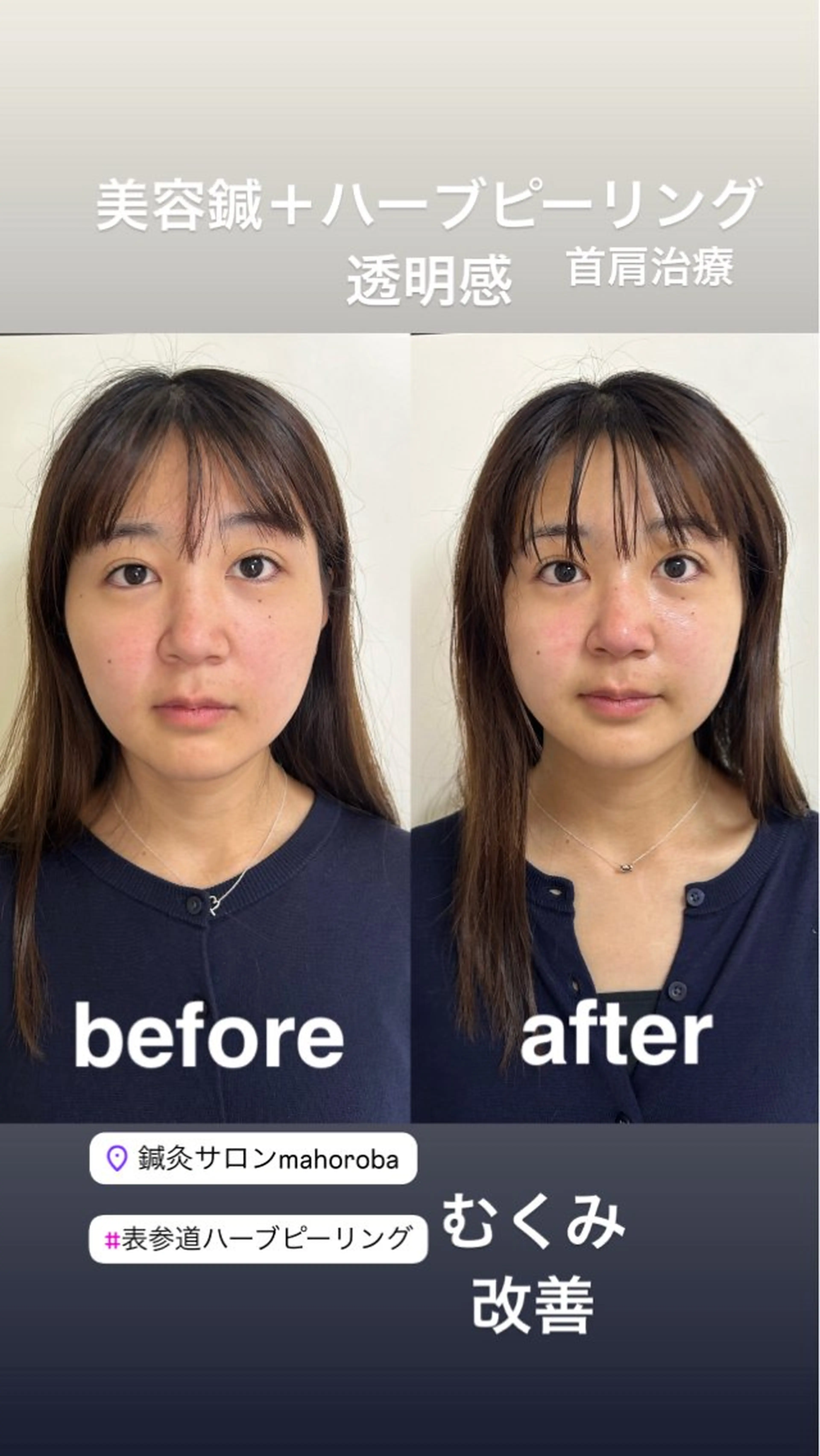 美容鍼灸サロン mahoroba院長のエステ・リラクイメージ