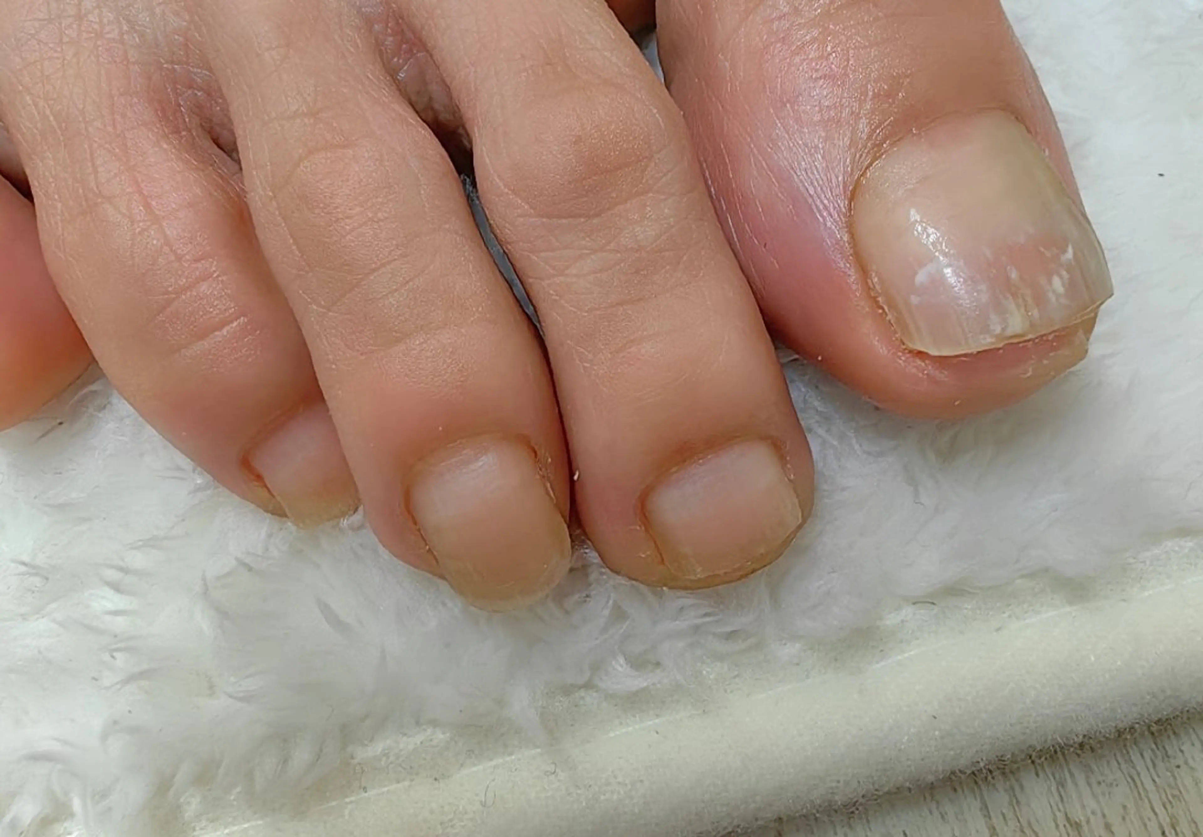 ネイル ハンドネイル フットネイル reve あやののその他イメージ