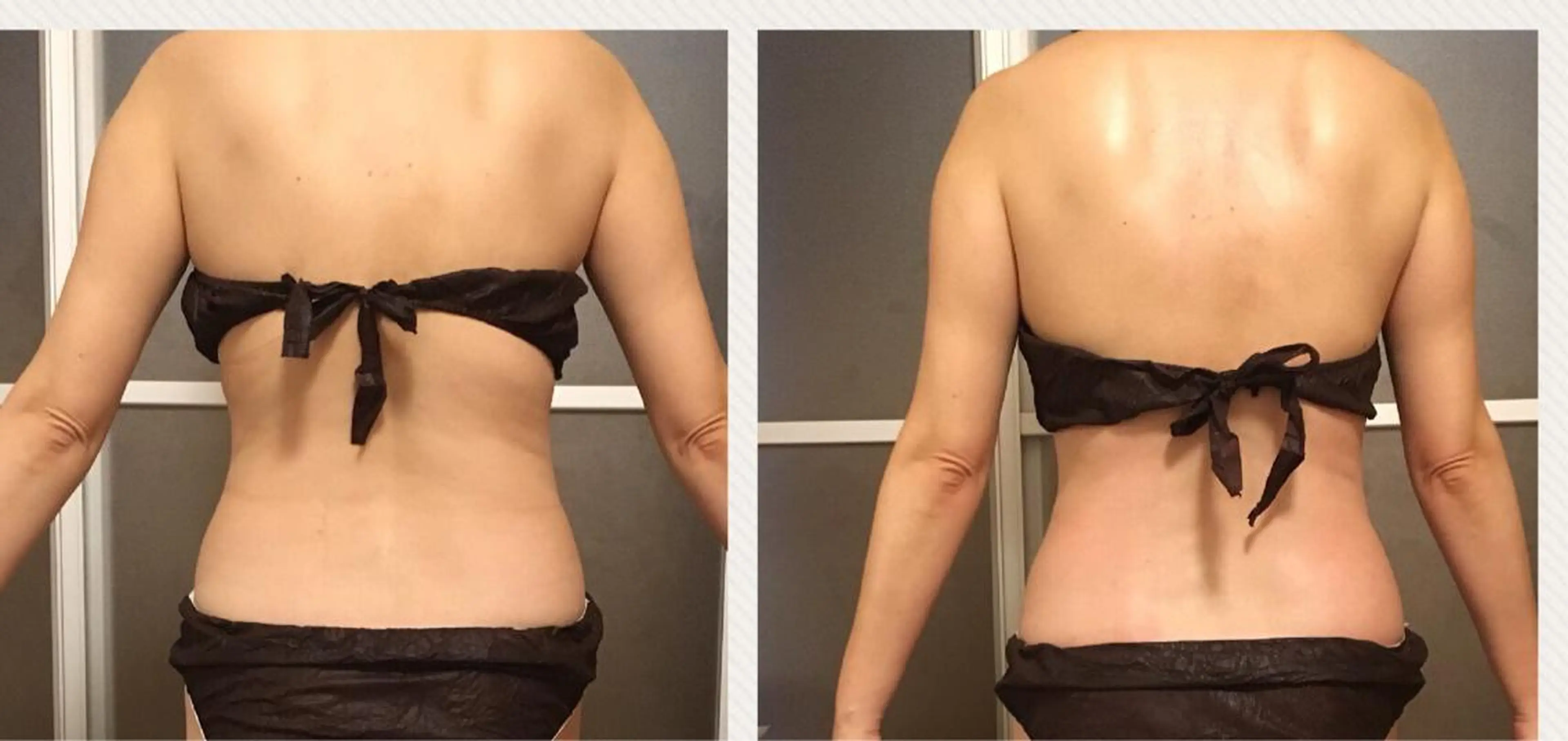 ロング カラー パーマ ヘアアレンジ メンズ キッズ ネイル マツエク・マツパ アニメ,Vオタク× 即効痩せエステサロンのエステ・リラクイメージ