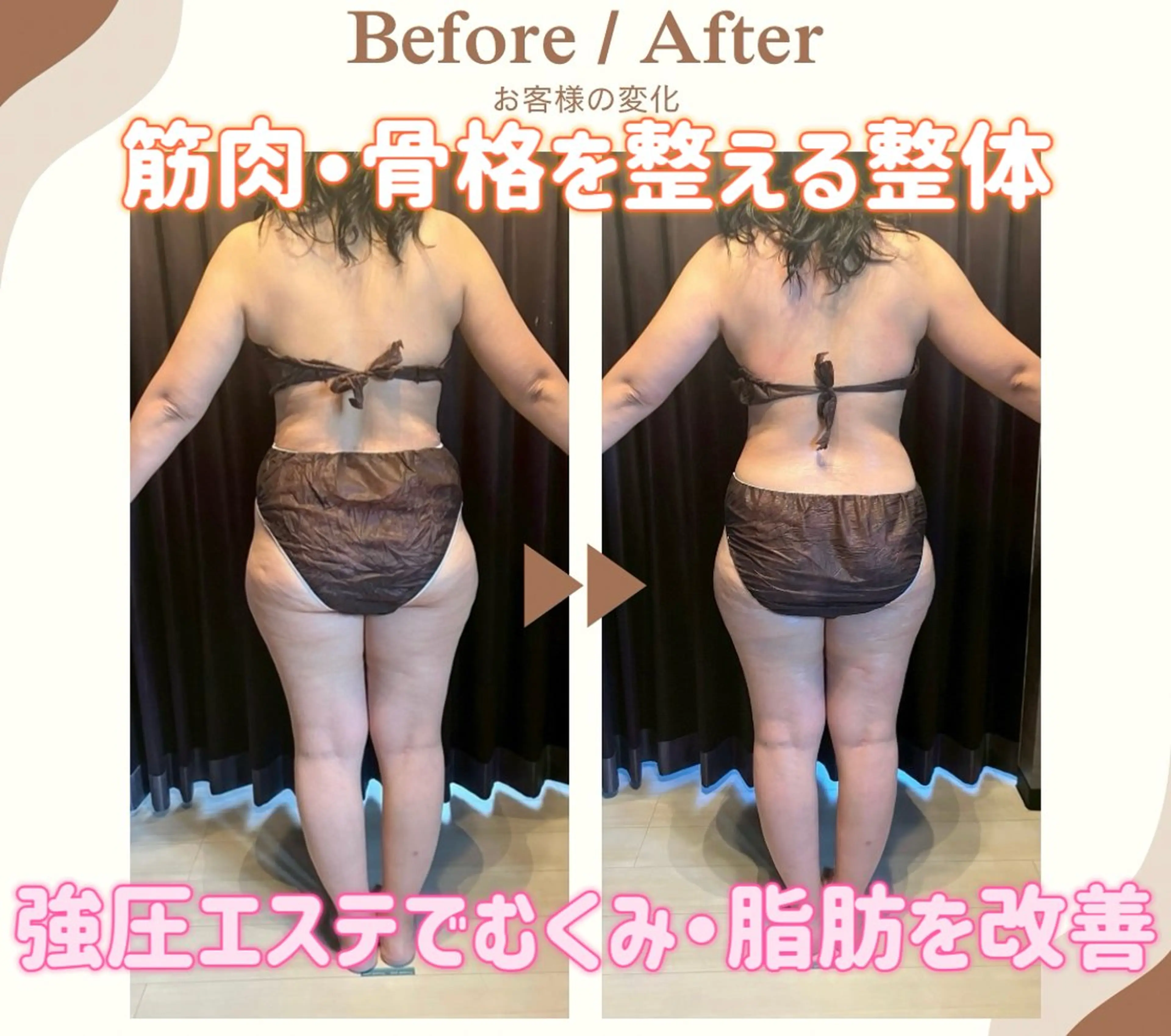 【確実に痩せたいなら】整体×全身強圧エステ×小顔矯正しっかり100分¥13980の写真