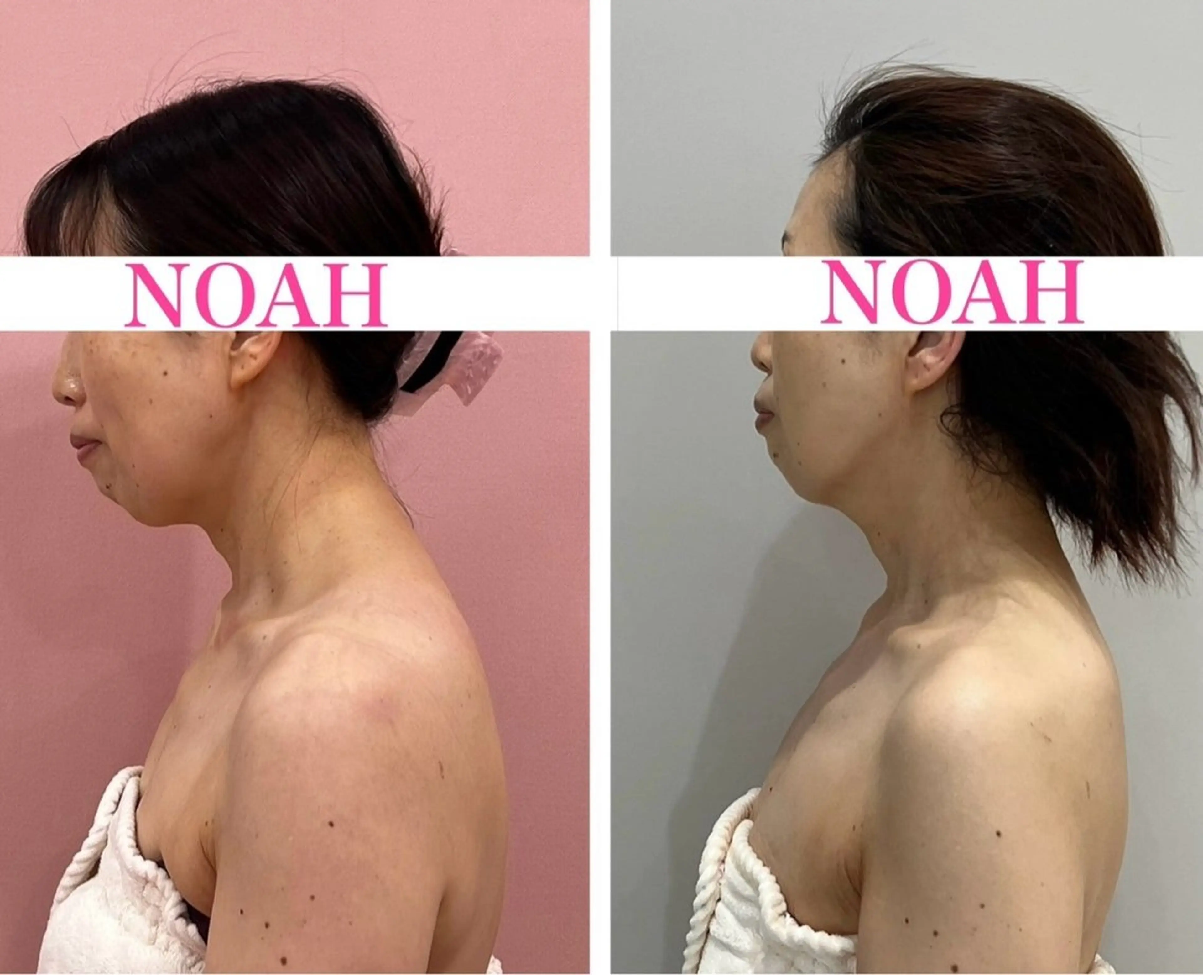 NOAH 小顔毛穴 川越店所属・NOAH ORIEのエステ・リラクイメージ