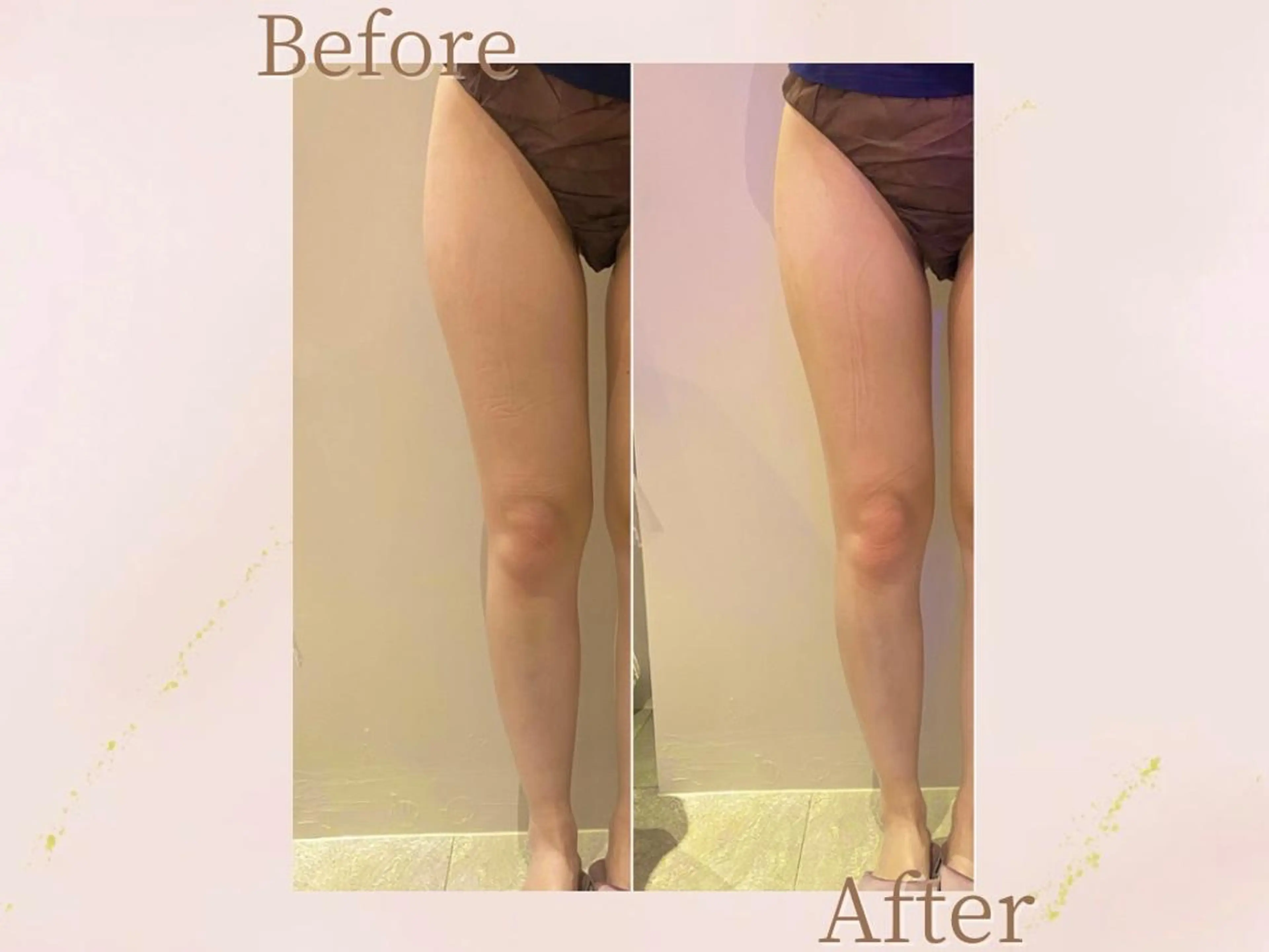 エステ 森近 美優のエステ・リラクイメージ