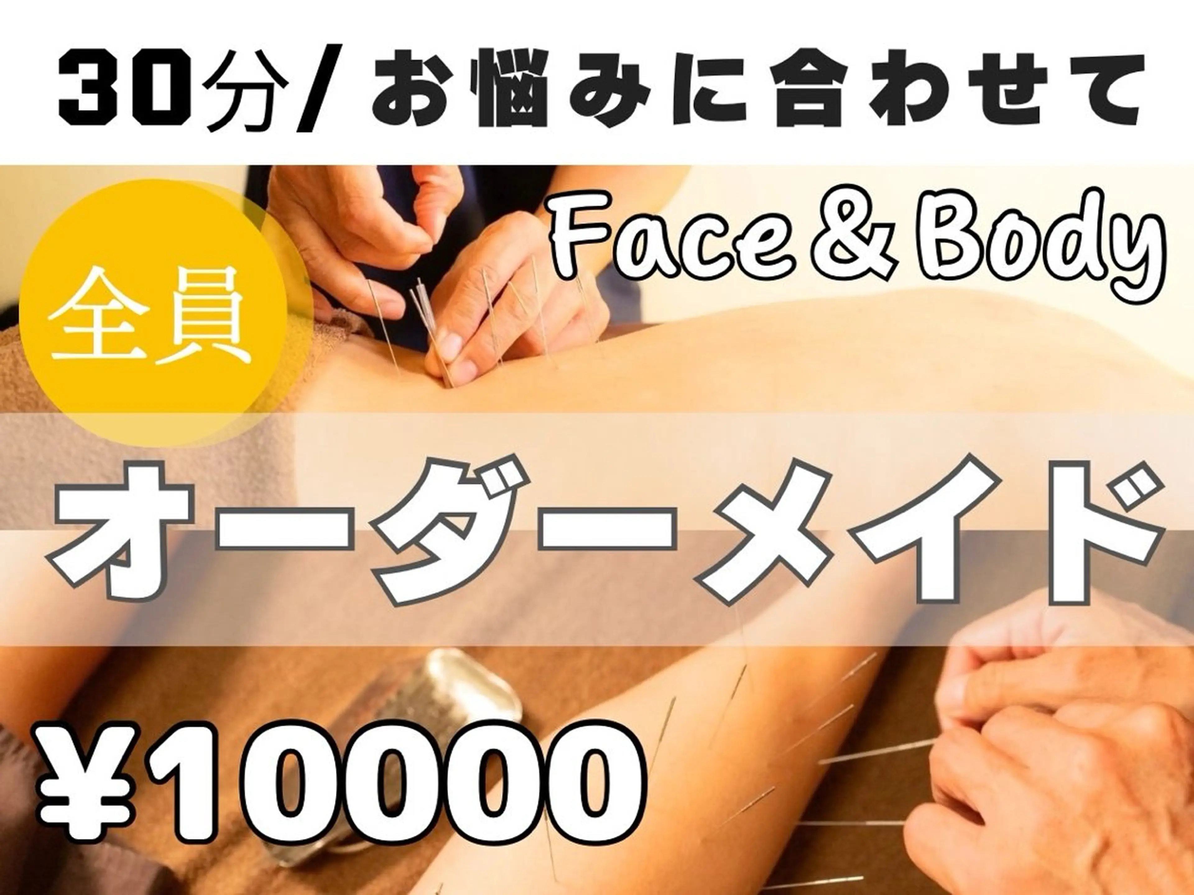 【オーダーメイドコース】ルート鍼30分¥10,000の写真
