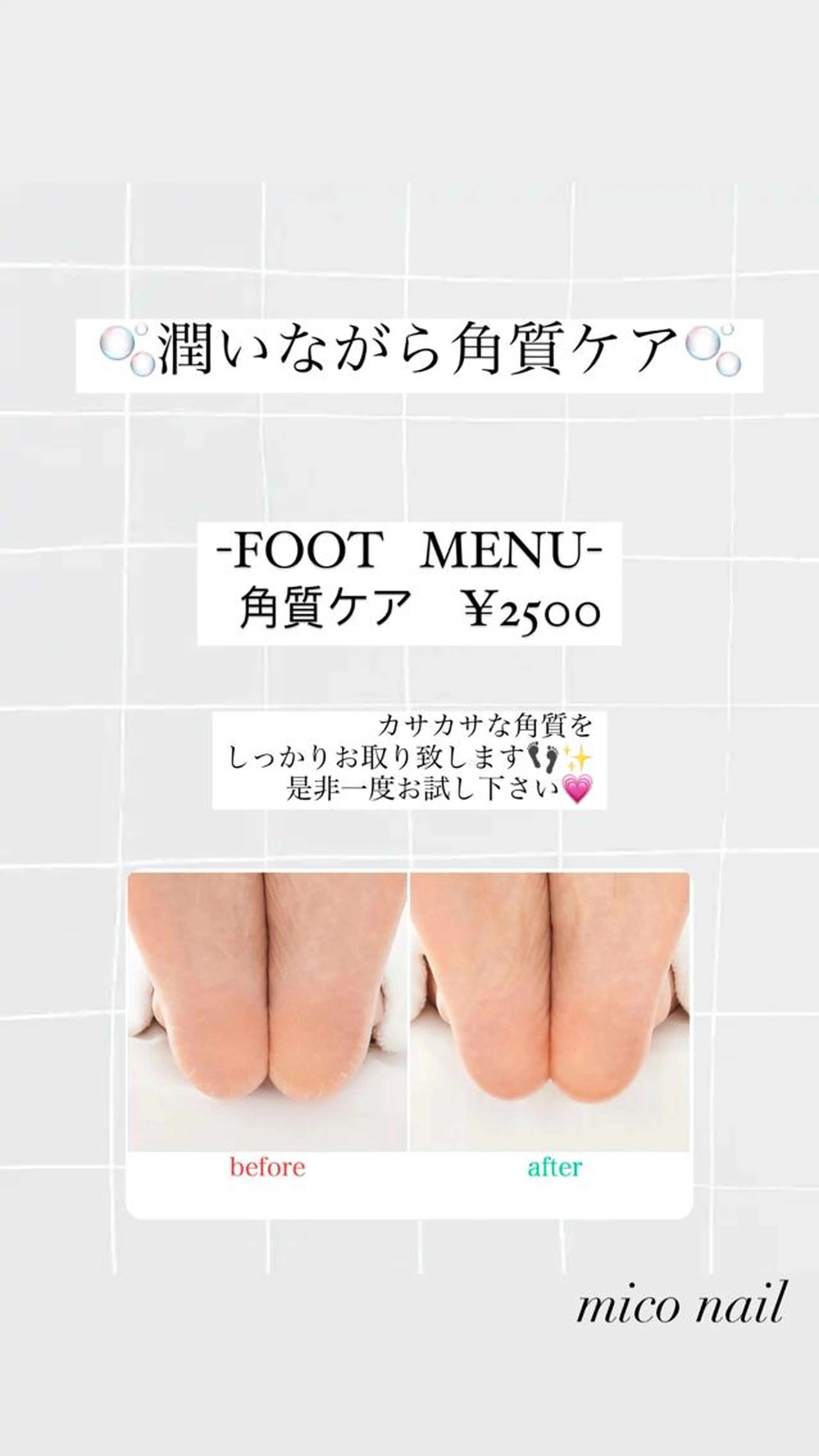 フット角質ケアの写真