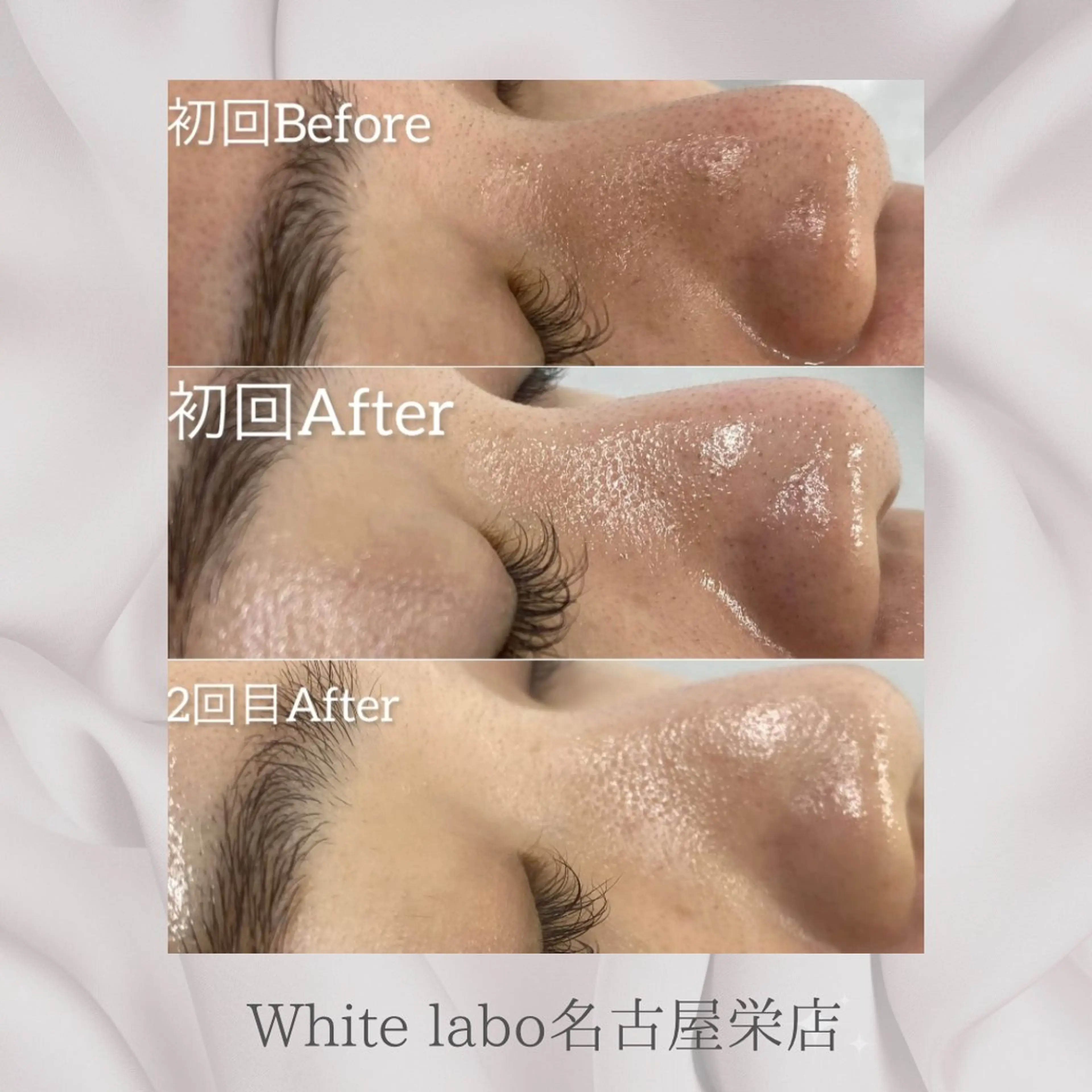 White labo 🇰🇷REIの眉毛・アイブロウイメージ