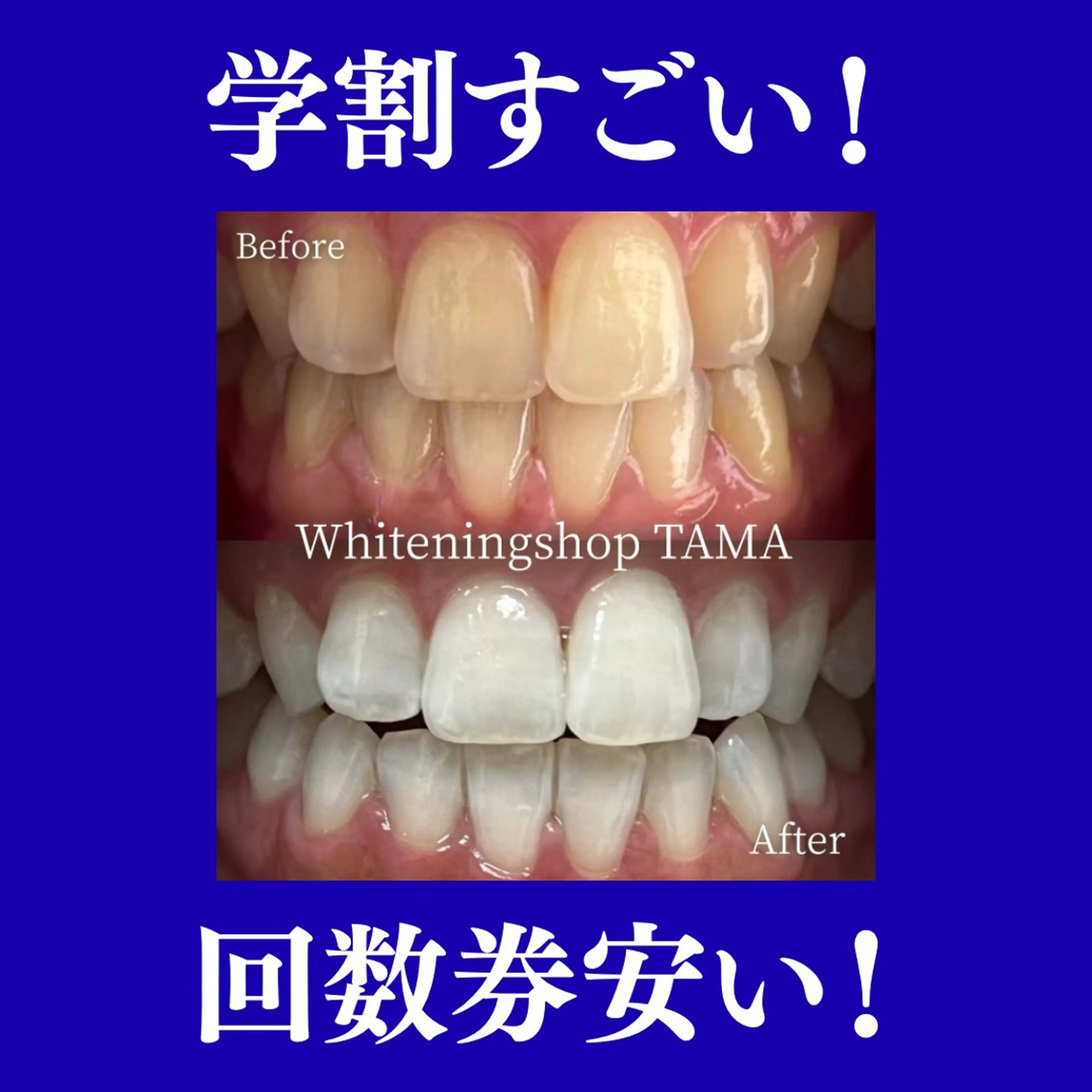 ホワイトニング ショップ多摩店のその他イメージ