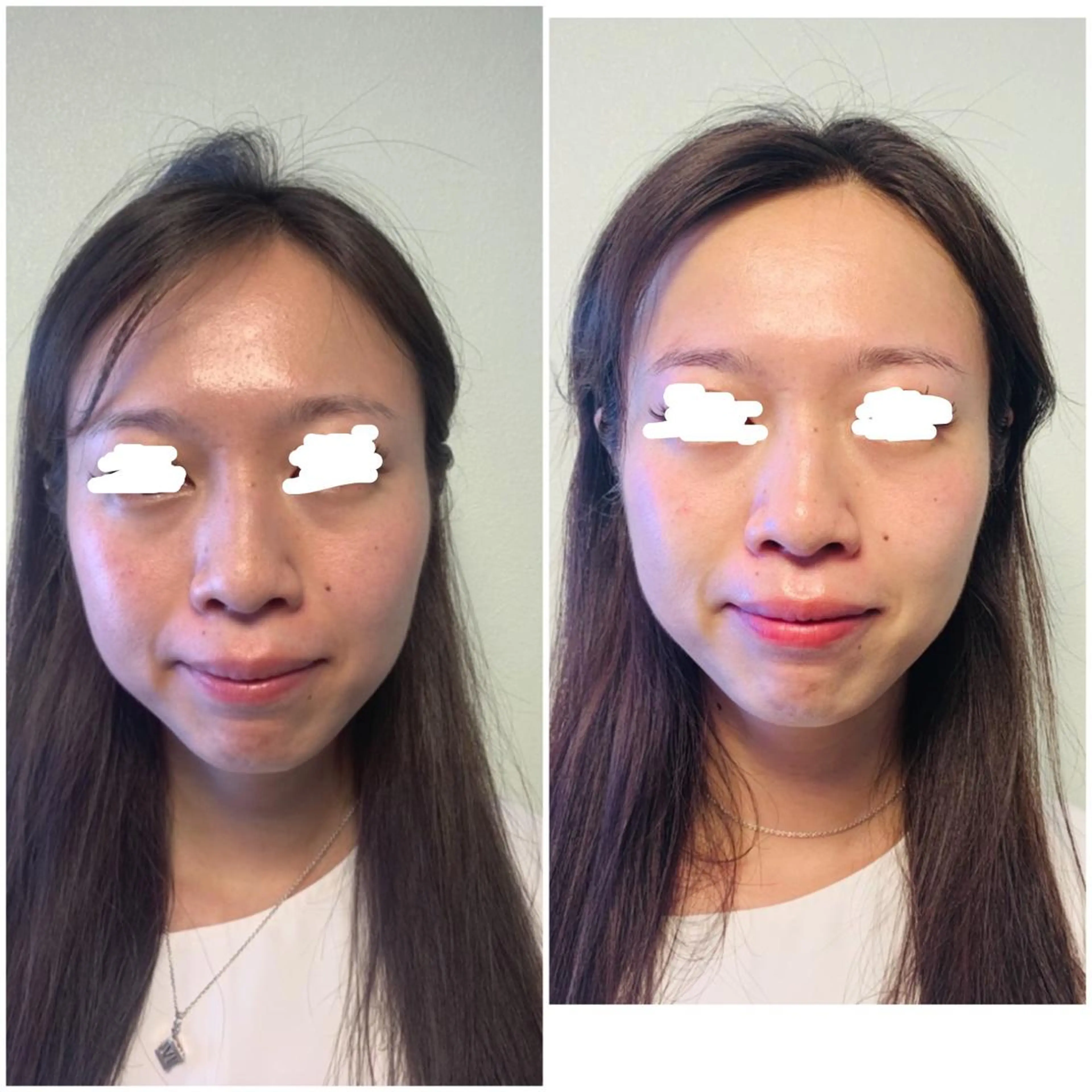 aliaハイフ&水光ジェットサロン所属・aliaハーブ水光店 エステティシャン募集のエステ・リラクイメージ