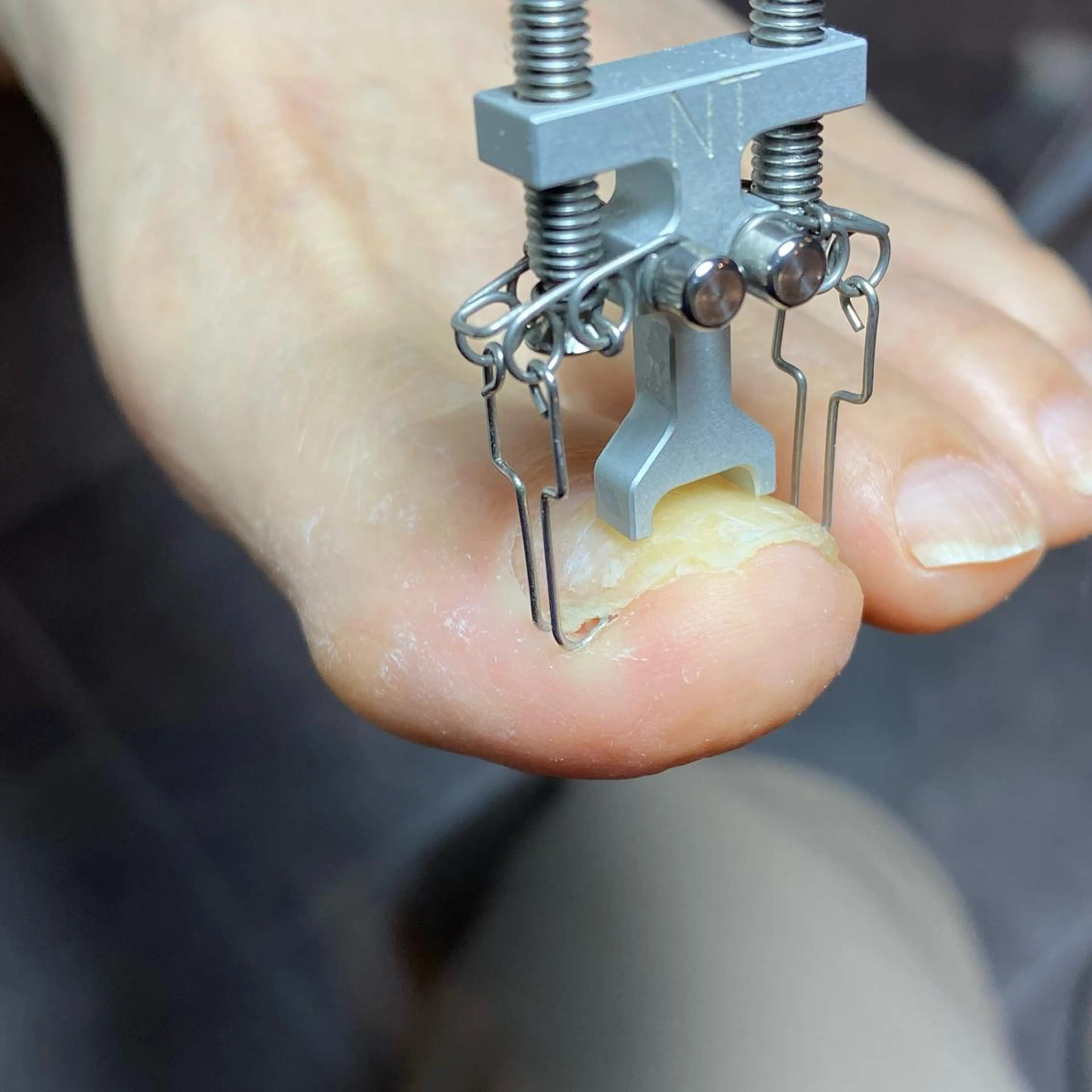 ネイル 長さ出し フットネイル ジェルネイル フットネイル 〜Nail Tailor〜 ネイルテイラー所属・NailTailor ネイルテイラーのネイルデザイン