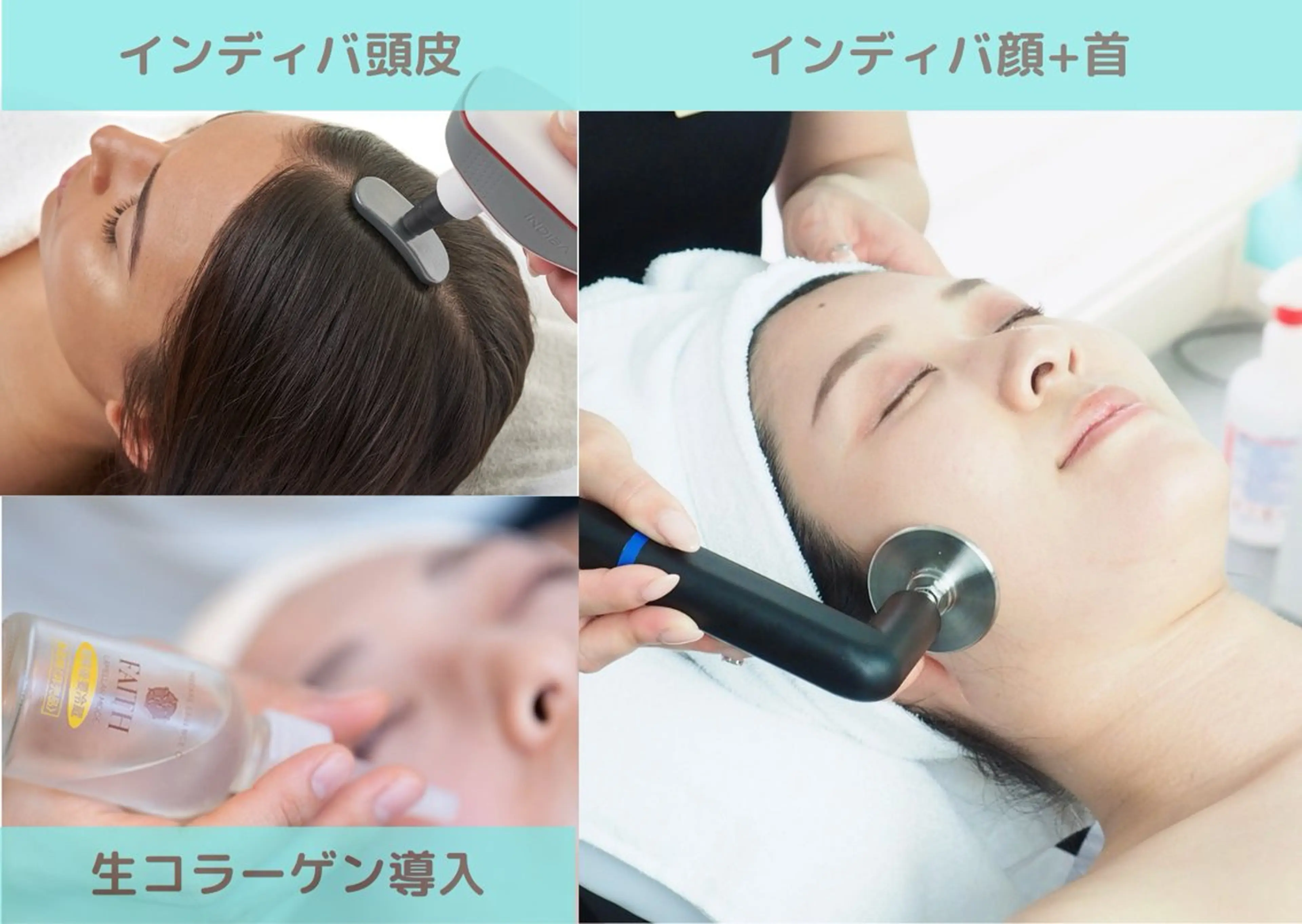 🔥ギャンペーン40%OFF【インディバ癒しフェイシャル】◎インディバ小顔＋生コラーゲンパック★乾燥に対策！リフトアップの写真